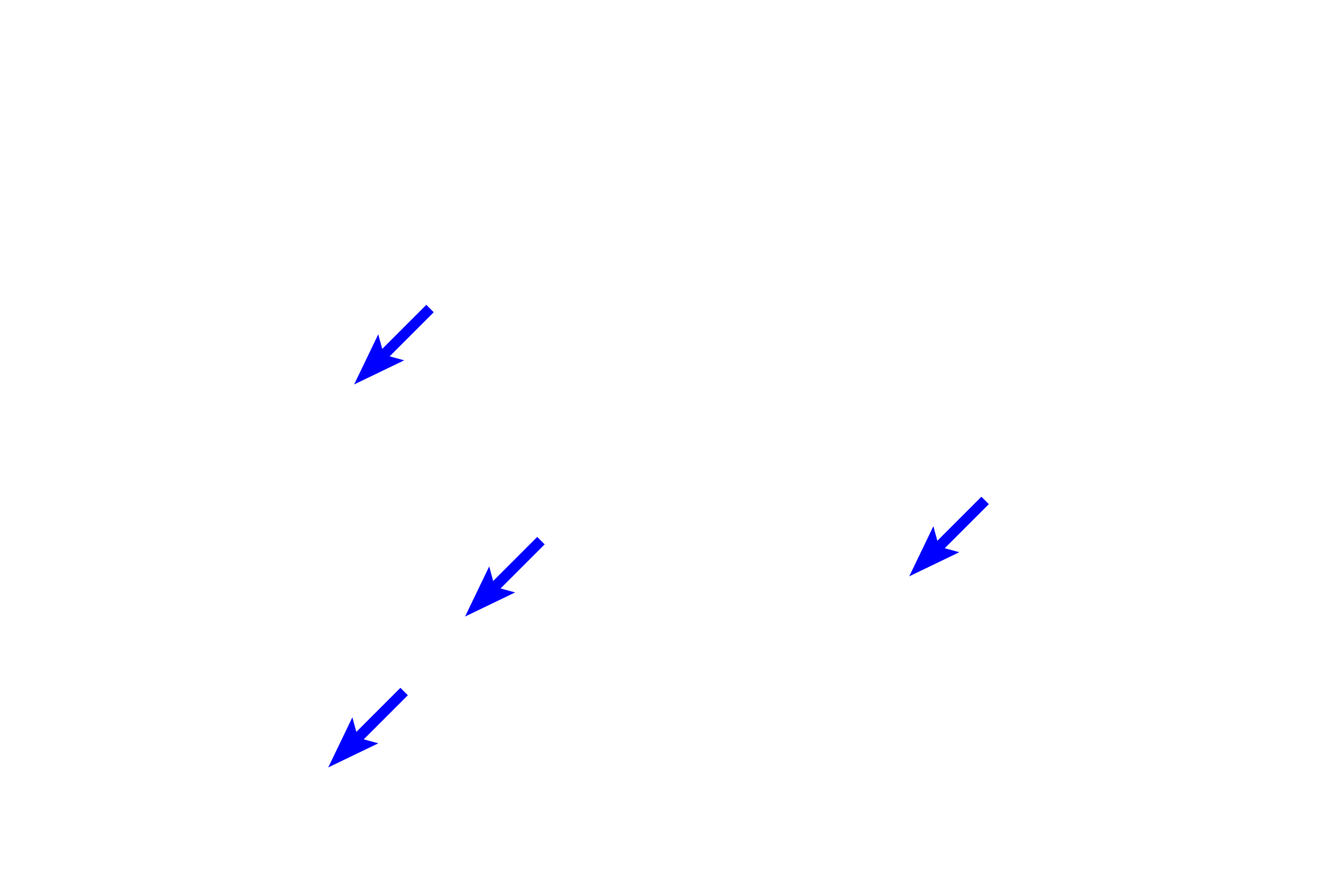  - Capillaries <p>Closely spaced alveoli forming the wall of alveolar ducts are separated by thin interalveolar septa capped by knobs containing smooth muscle. The smooth muscle forms a sphincter-like ring around the opening of each alveolus and is lined by a simple cuboidal epithelium, without cilia or club cells. The interalveolar septum possesses numerous capillaries where gas exchange occurs. 800x</p>
