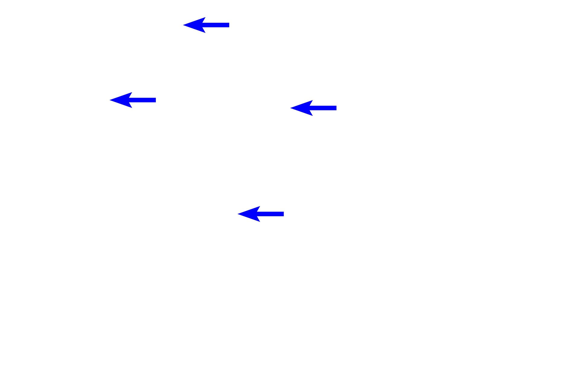 Knobs <p>Alveolar ducts terminate as alveolar sacs, blind-ended pouches composed of clustered alveoli. Interalveolar septa in alveolar sacs generally lack smooth muscle knobs.  200x</p>
