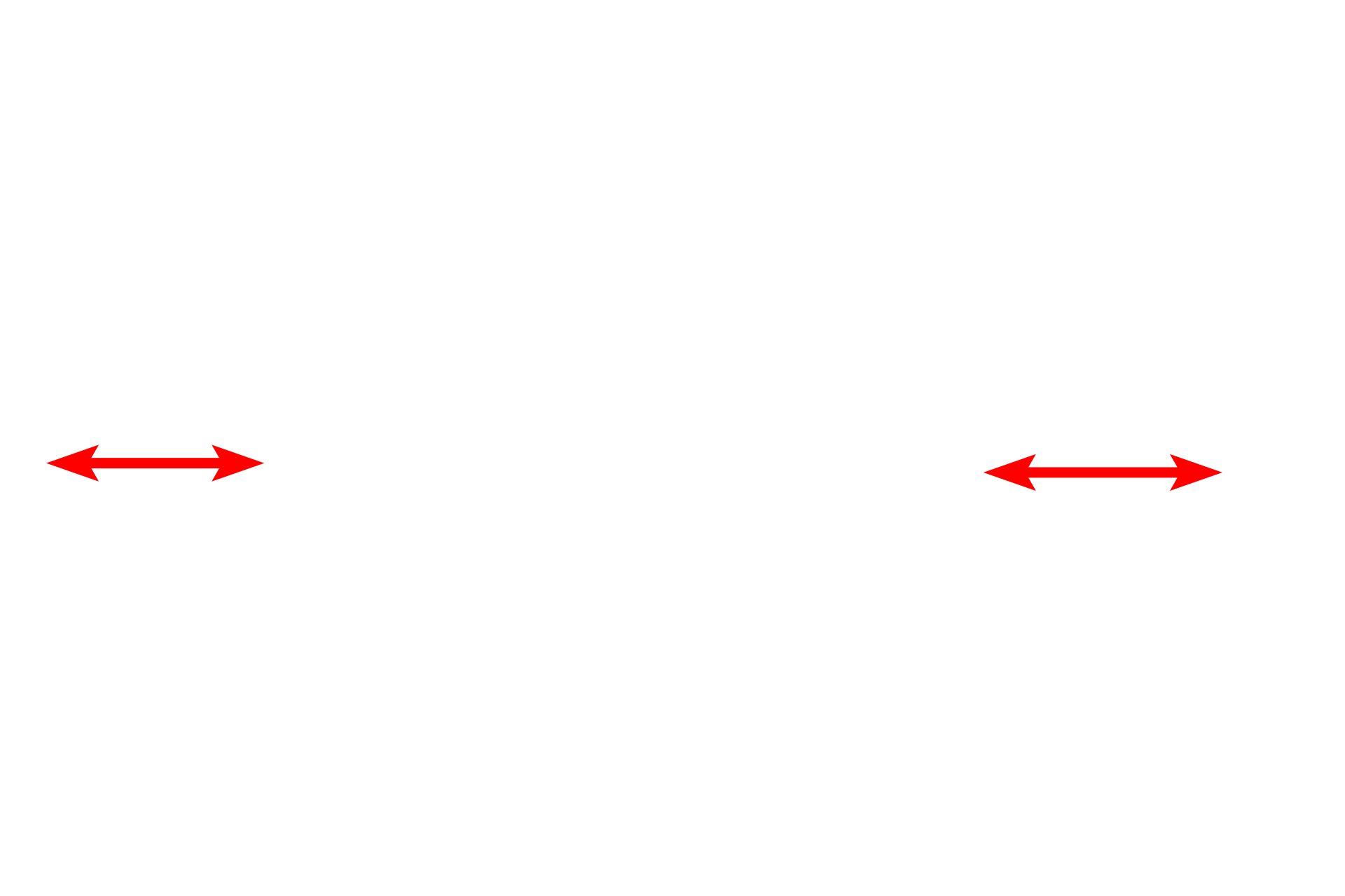Interalveolar septa <p>A single alveolus of an alveolar duct is shown at high magnification. Interalveolar septa with smooth muscle knobs and numerous capillaries separate adjacent alveolar lumens.  1000x</p>
