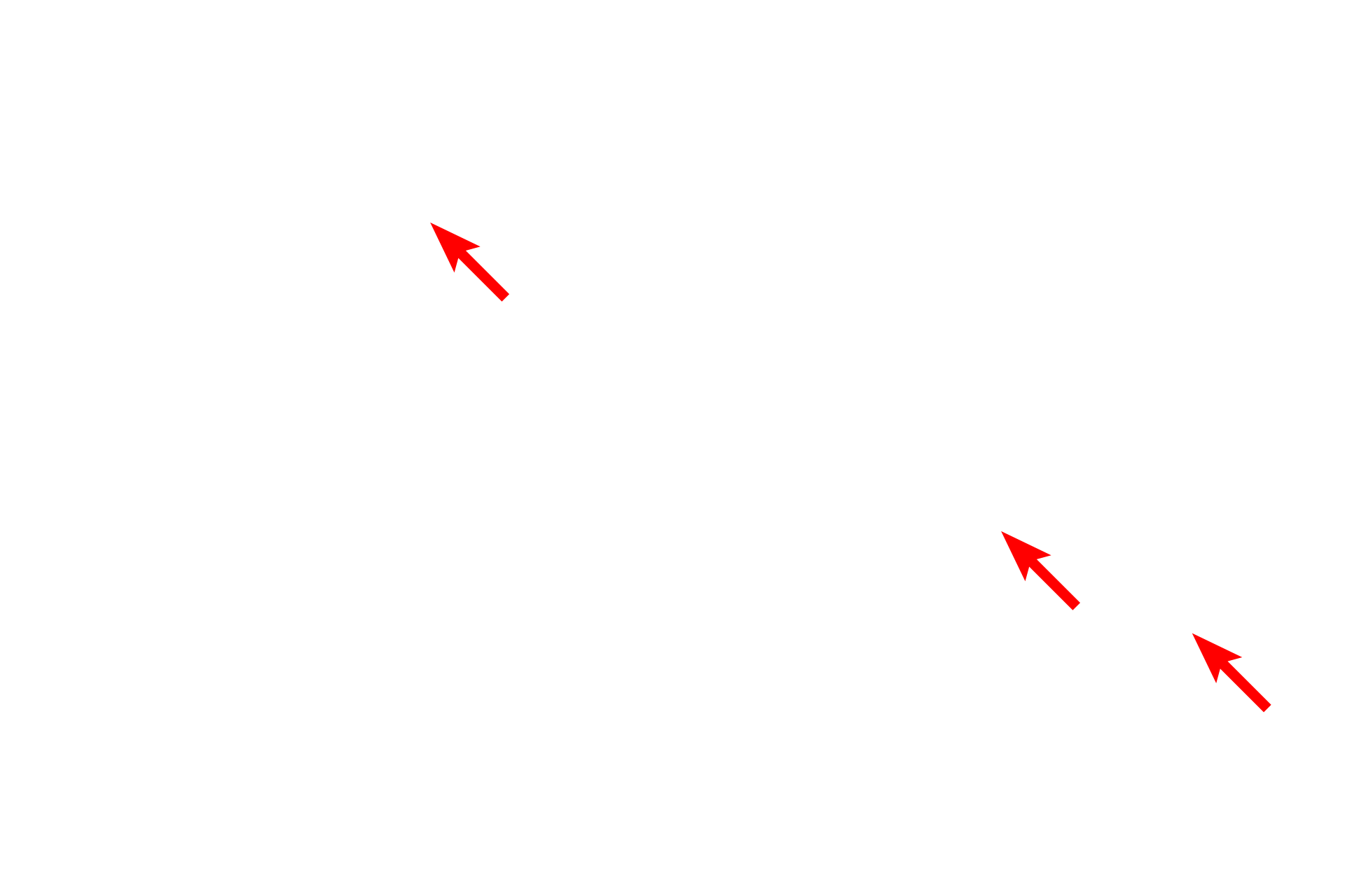  -- Blood cells <p>A single alveolus of an alveolar duct is shown at high magnification. Interalveolar septa with smooth muscle knobs and numerous capillaries separate adjacent alveolar lumens.  1000x</p>
