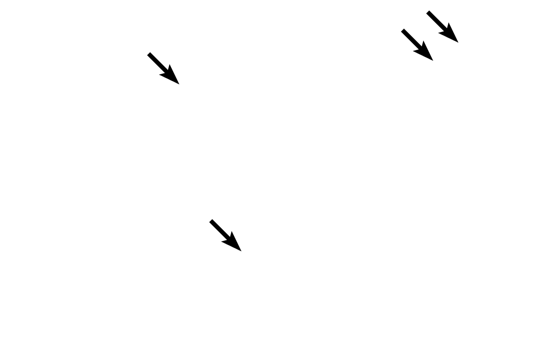 Pulmonary arteries > <p>These vessels accompany the bronchiole and carries deoxygenated blood to the alveoli for gas exchange.</p>
