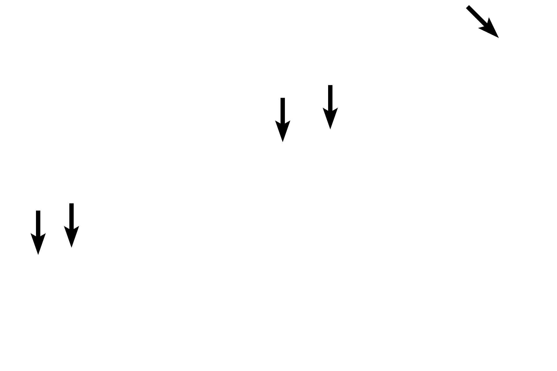 Epithelium <p>Respiratory bronchioles are lined by ciliated cuboidal cells and club cells. The epithelium is interrupted by the presence of alveoli and thus respiratory bronchioles are the first sites where gas exchange with the air occurs.  600x</p>
