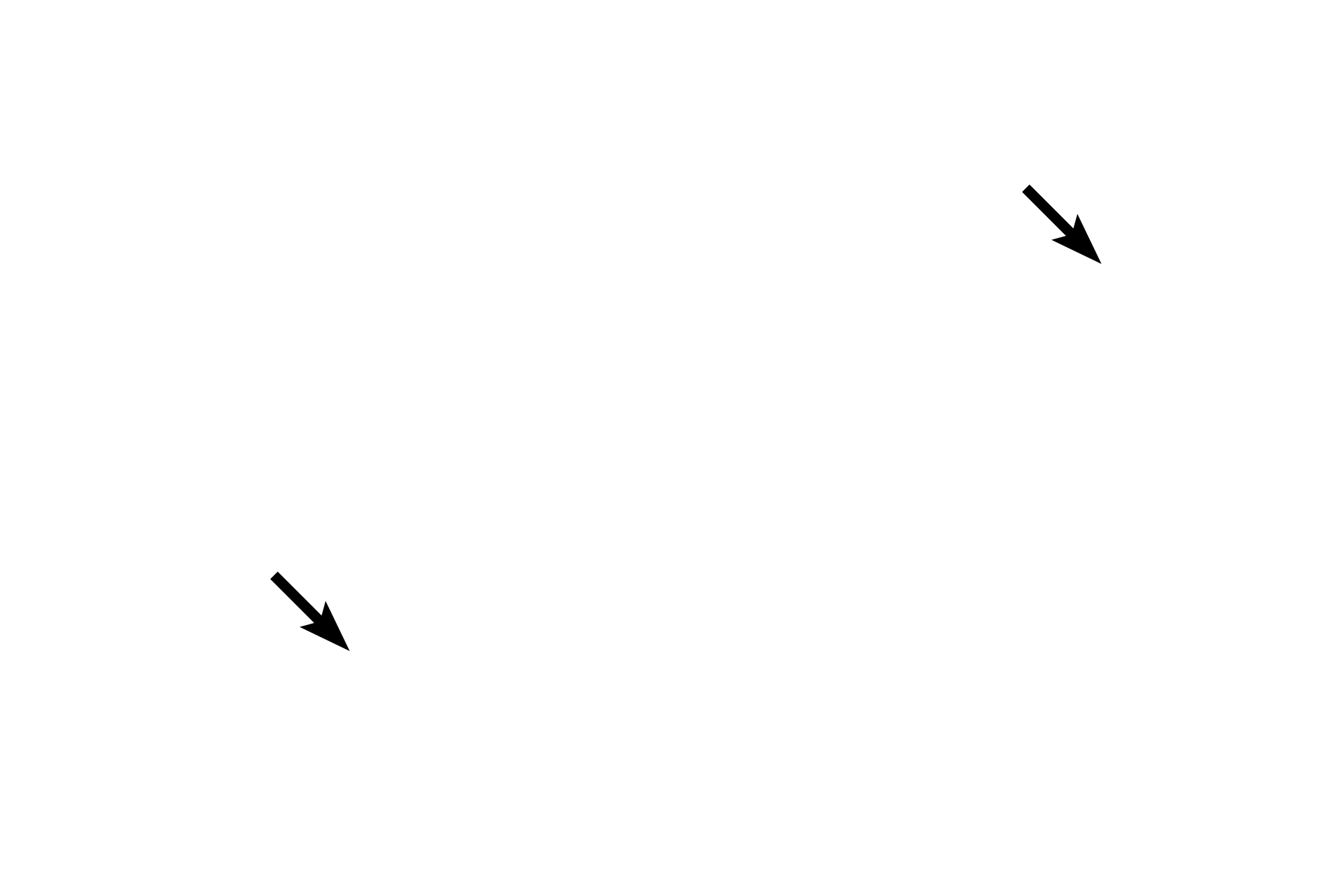 Associated alveoli <p>Respiratory bronchioles are lined by ciliated cuboidal cells and club cells. The epithelium is interrupted by the presence of alveoli and thus respiratory bronchioles are the first sites where gas exchange with the air occurs.  600x</p>
