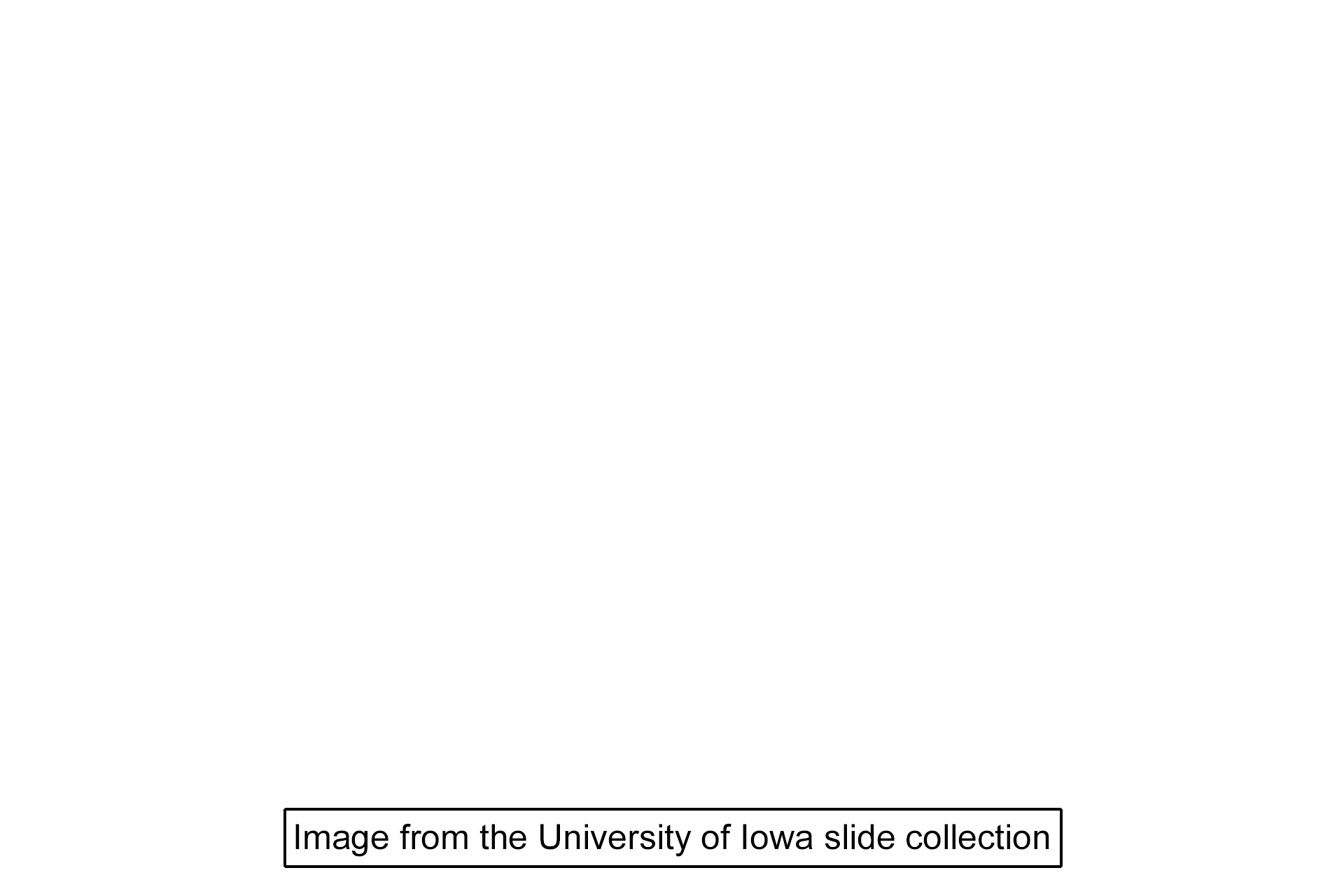 Image source > <p>This image was taken of a slide from the University of Michigan collection.</p>
