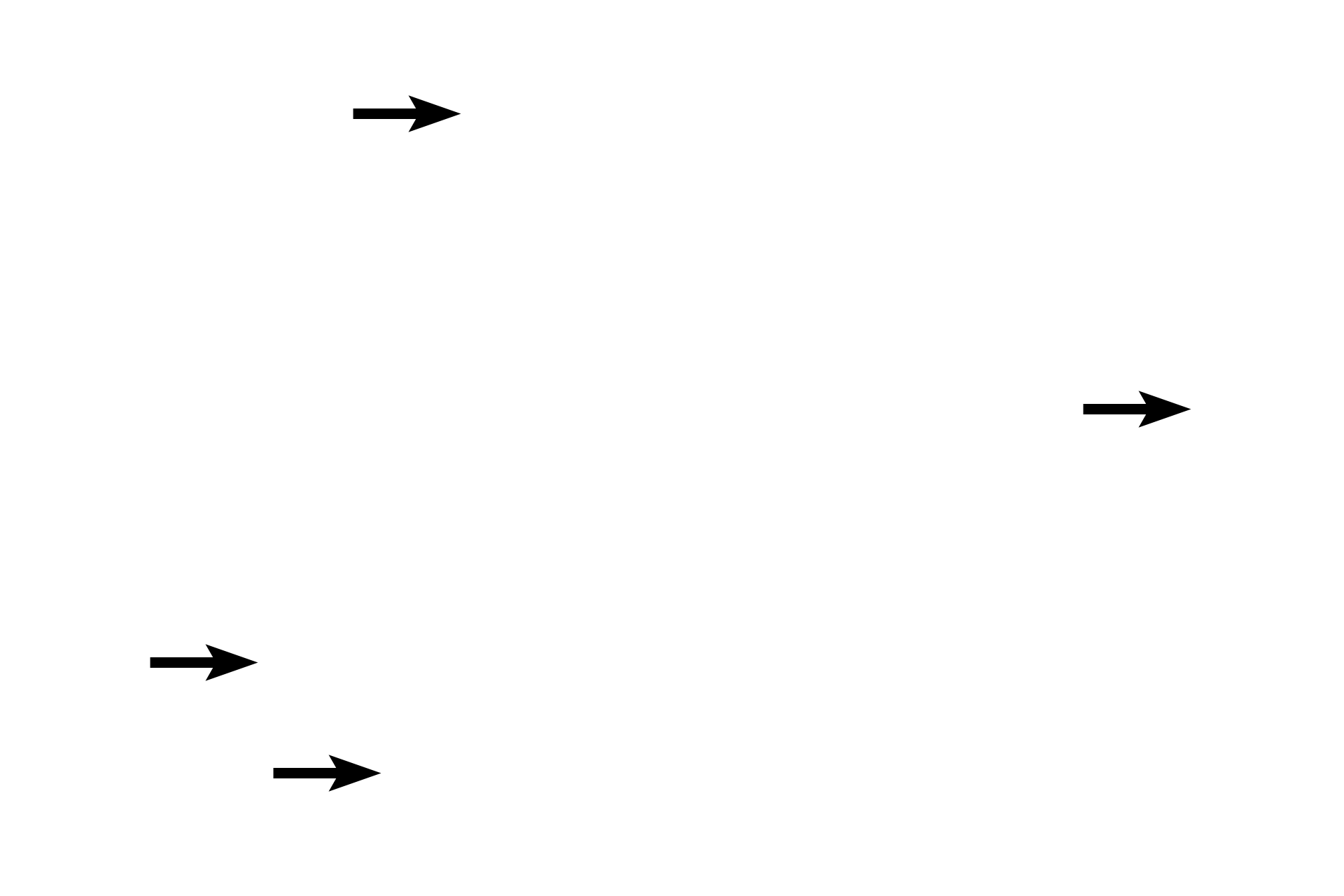 Pulmonary vessels <p>A respiratory bronchiole, seen here in cross section, is lined by a simple, ciliated cuboidal epithelium with club cells and scattered cilia. The epithelium appears interrupted due to presence of alveoli which are an integral part of its wall. Alveoli from adjacent respiratory bronchioles and alveolar ducts surround this bronchiole. 400x</p>
