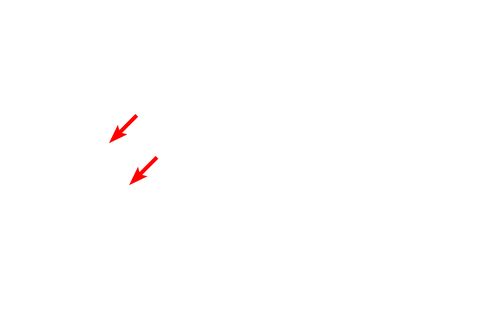  - Bronchiole epithelium <p>This passageway includes portions of a bronchiole and a terminal bronchiole.</p>
