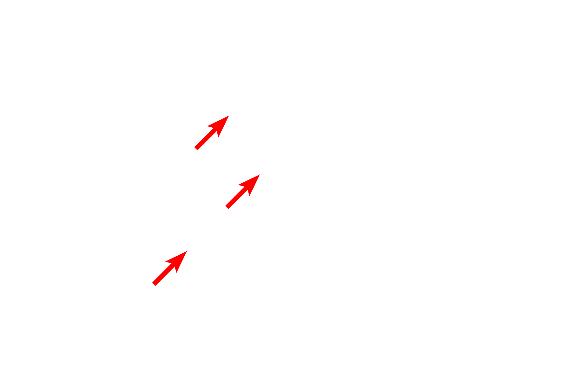  - Terminal bronchiole epithelium <p>This passageway includes portions of a bronchiole and a terminal bronchiole.</p>

