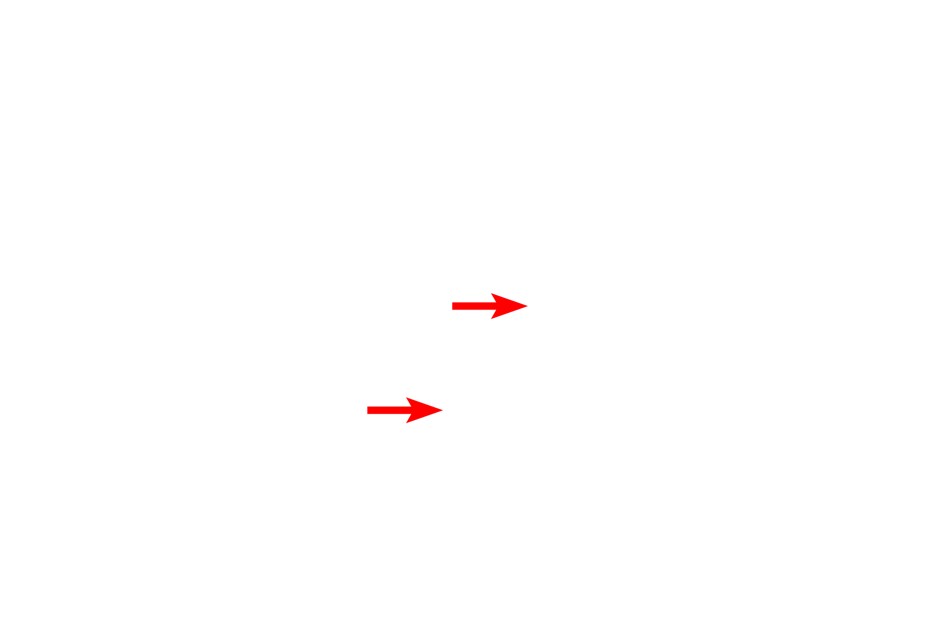  - Epithelium <p>Transitions from bronchiole to terminal bronchiole to alveolar duct are shown in this thin section of primate lung. The bronchiole segment, lined by a ciliated, pseudostratified, columnar epithelium with goblet cells, transitions to the simple cuboidal epithelium of the short terminal bronchiole. Thereafter, the epithelium becomes interrupted by the presence of alveoli, indicating the start of the respiratory bronchiole. Alveolar ducts consists almost entirely of alveoli, the wall being reduced to knob-like interalveolar septa.  Toluidine blue, 300x  </p>

