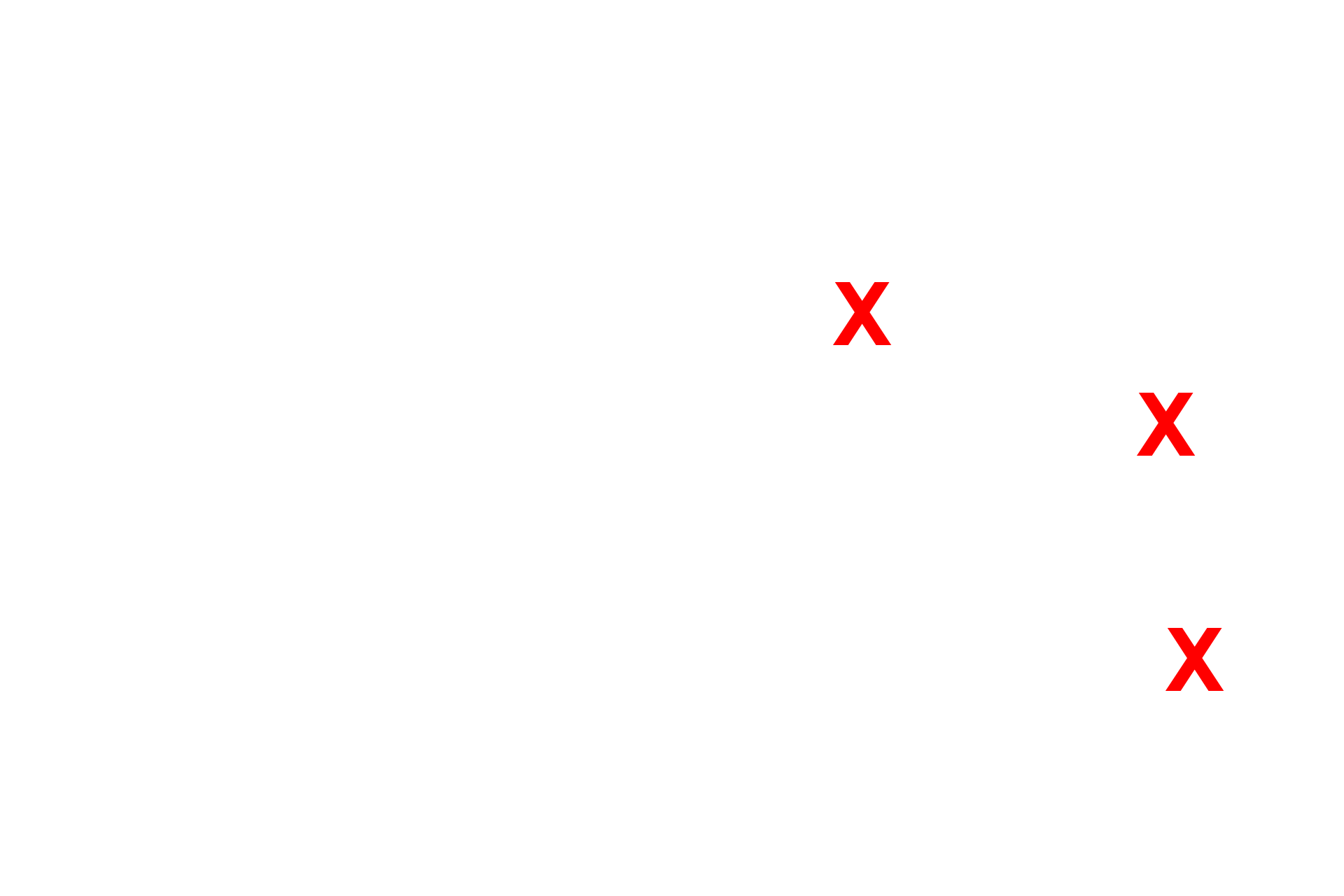  - Alveoli <p>Respiratory bronchioles are lined by the same epithelium as terminal bronchioles but is interrupted by the presence of alveoli in the wall.  </p>
