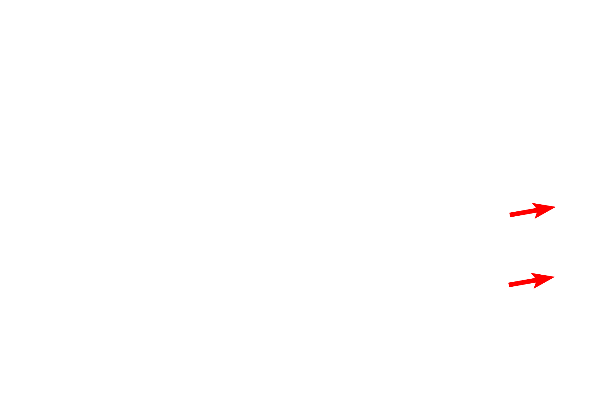  - Smooth muscle knobs <p>Respiratory bronchioles continue as alveolar ducts, elongated passageways whose walls consist almost entirely of alveoli. The opening of each alveolus is surrounded by a ring of smooth that appears like a “knob” in cross section.</p>
