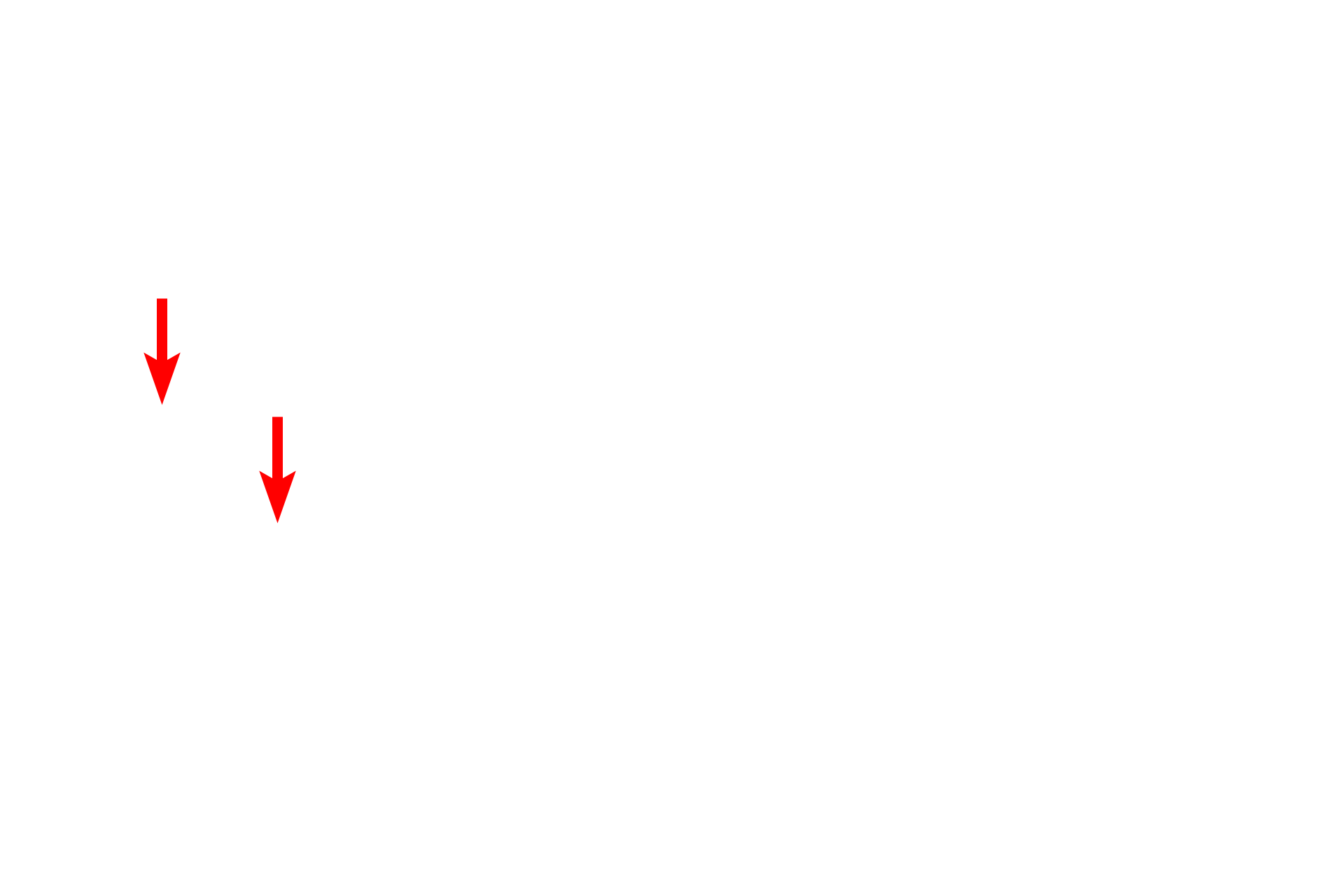  -- Cilia <p>Bronchioles are lined by a simple columnar/cuboidal epithelium with cilia and goblet cells. </p>
