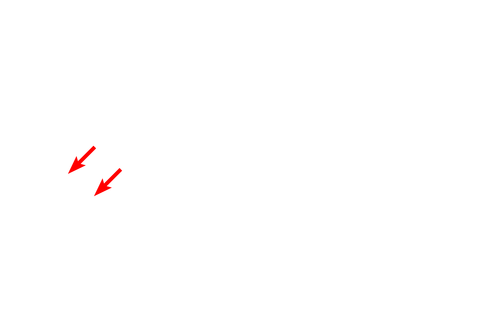  -- Goblet cells <p>Bronchioles are lined by a simple columnar/cuboidal epithelium with cilia and goblet cells. </p>
