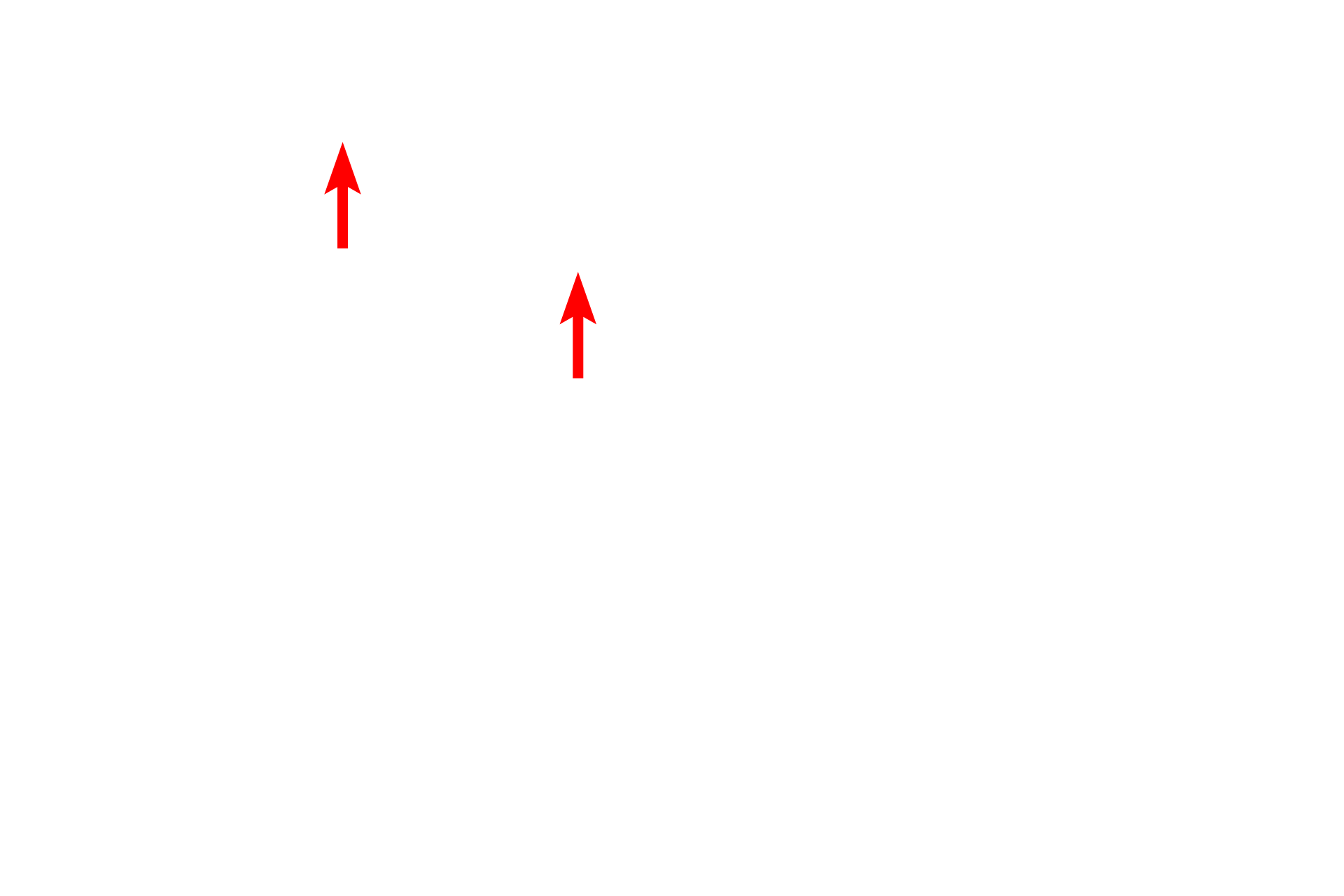  -- Cilia <p>Terminal bronchioles are lined by a simple cuboidal epithelium with sparse cilia and club cells. Goblet cells are not present.</p>
