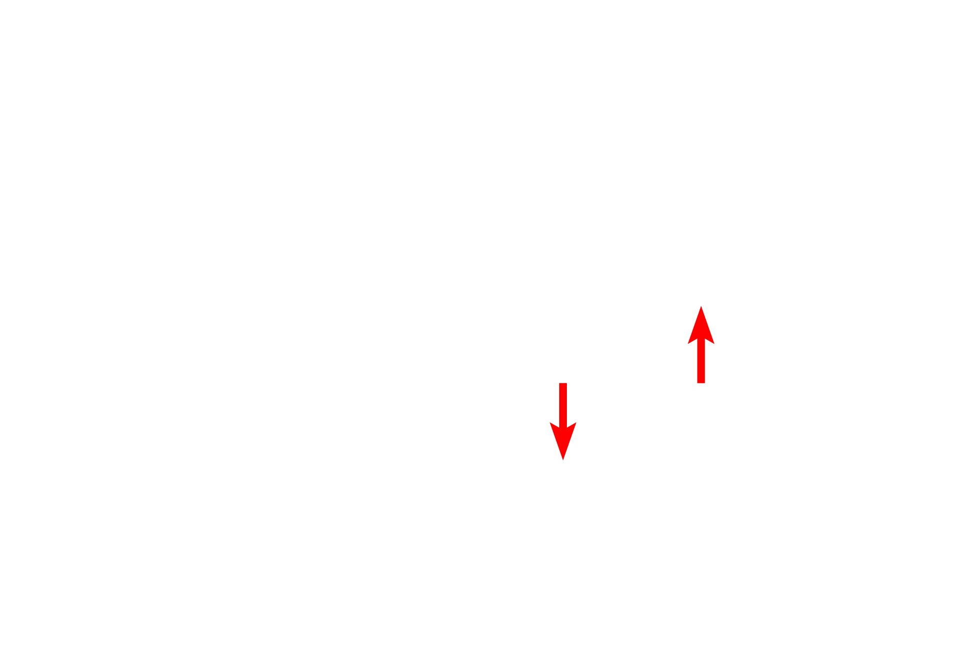  - Epithelium <p>Respiratory bronchioles are lined by the same epithelium as terminal bronchioles but is interrupted by the presence of alveoli in the wall. </p>
