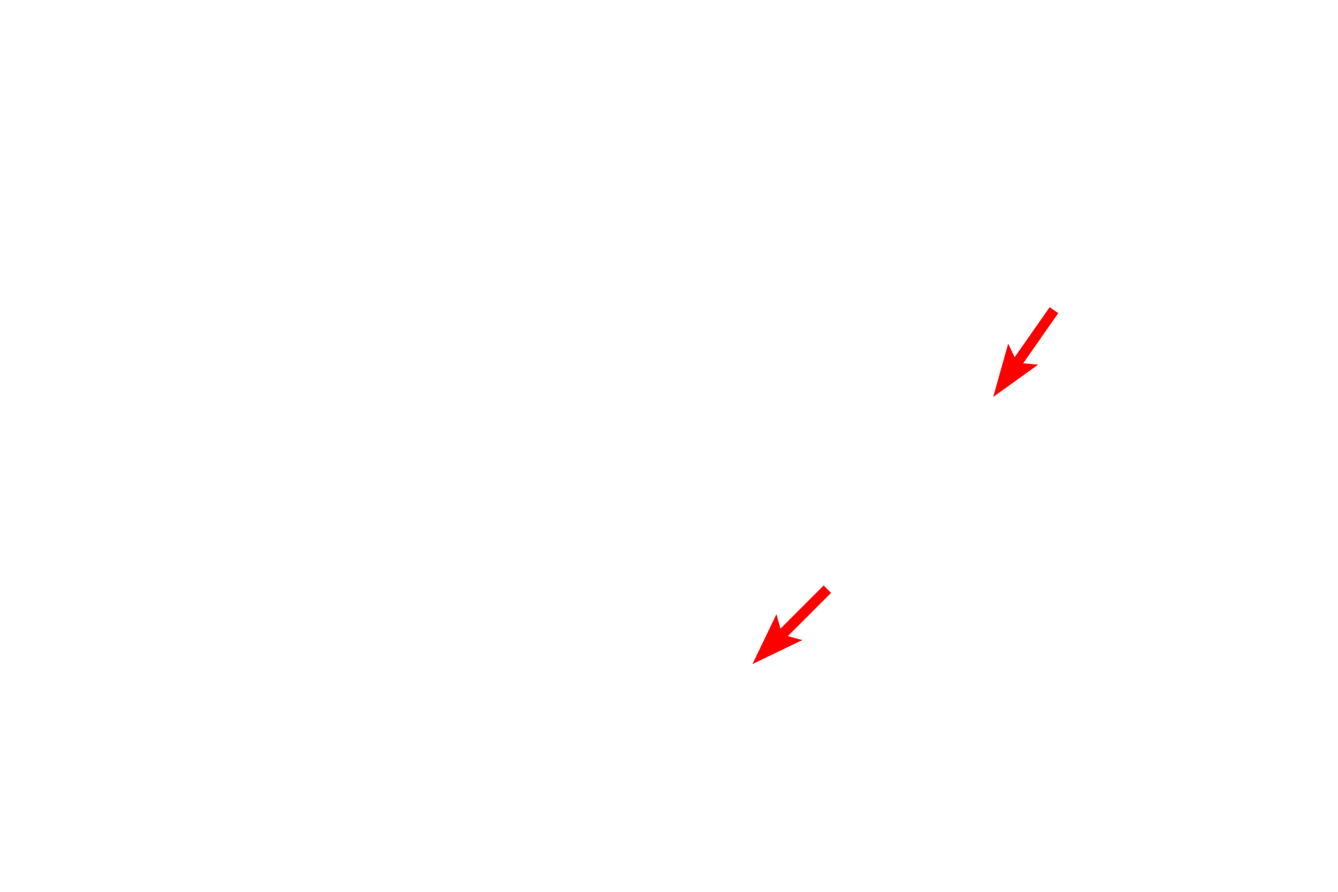  - Smooth muscle <p>Respiratory bronchioles are lined by the same epithelium as terminal bronchioles but is interrupted by the presence of alveoli in the wall.  </p>
