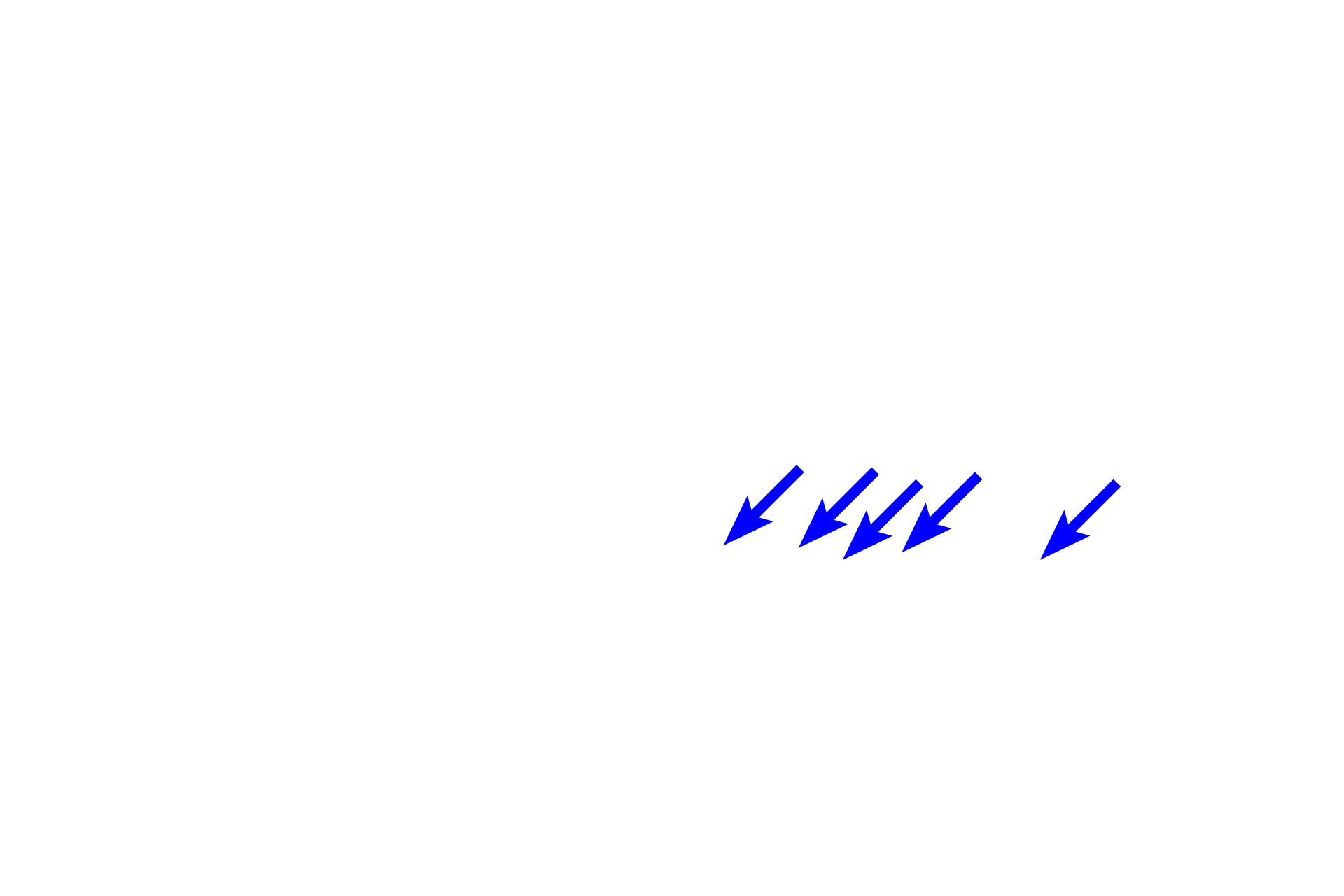  - Knobs <p>Respiratory bronchioles continue as alveolar ducts, elongated passageways whose walls consist almost entirely of alveoli. The opening of each alveolus is surrounded by a ring of smooth that appears like a “knob” in section. Alveolar ducts terminate as alveolar sacs, blind-ended pouches composed of clustered alveoli.  40x </p>
