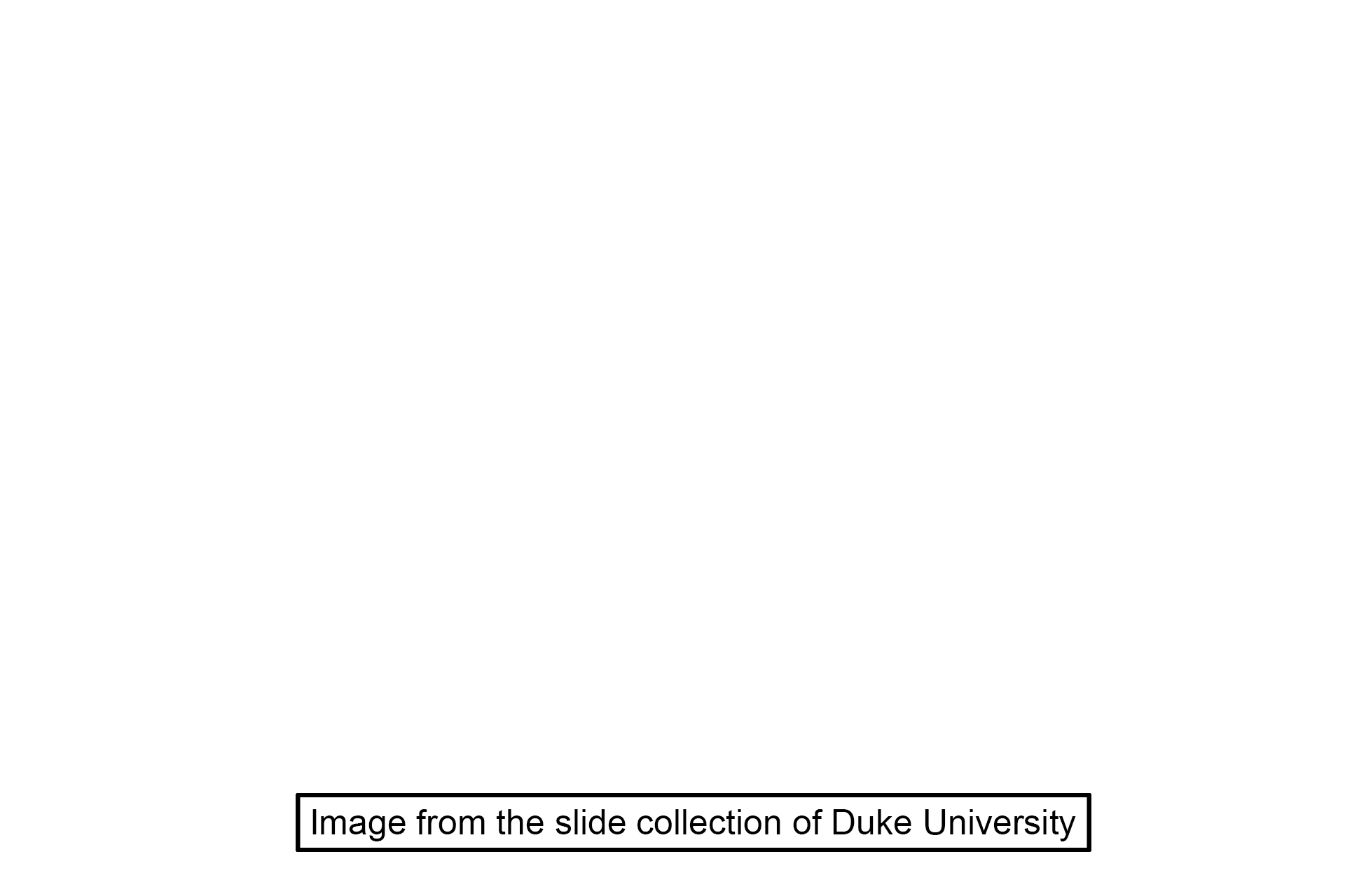 Image source <p>The image was taken of a slide in the Duke University collection.</p>
