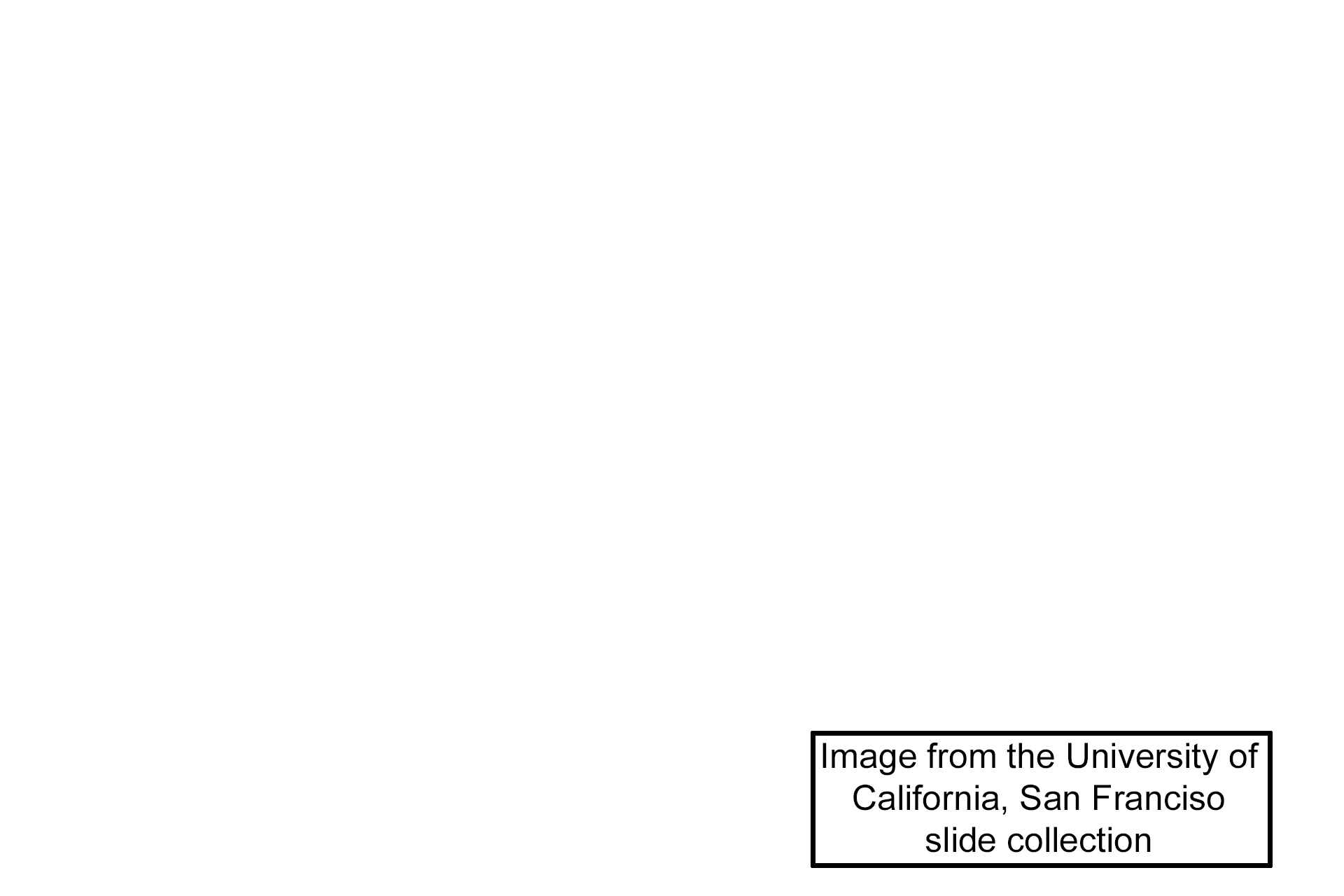 Image source > <p>This image was taken of a slide in the University of California, San Francisco collection.</p>
