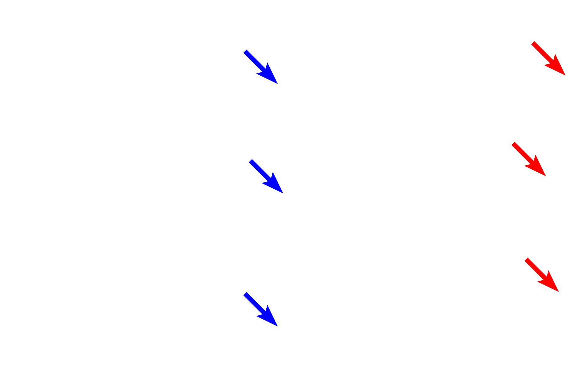  - Mesothelium <p>Pleura is composed of a simple squamous epithelium (mesothelium) overlying a layer of connective tissue that contains blood vessels and elastic fibers. </p>

