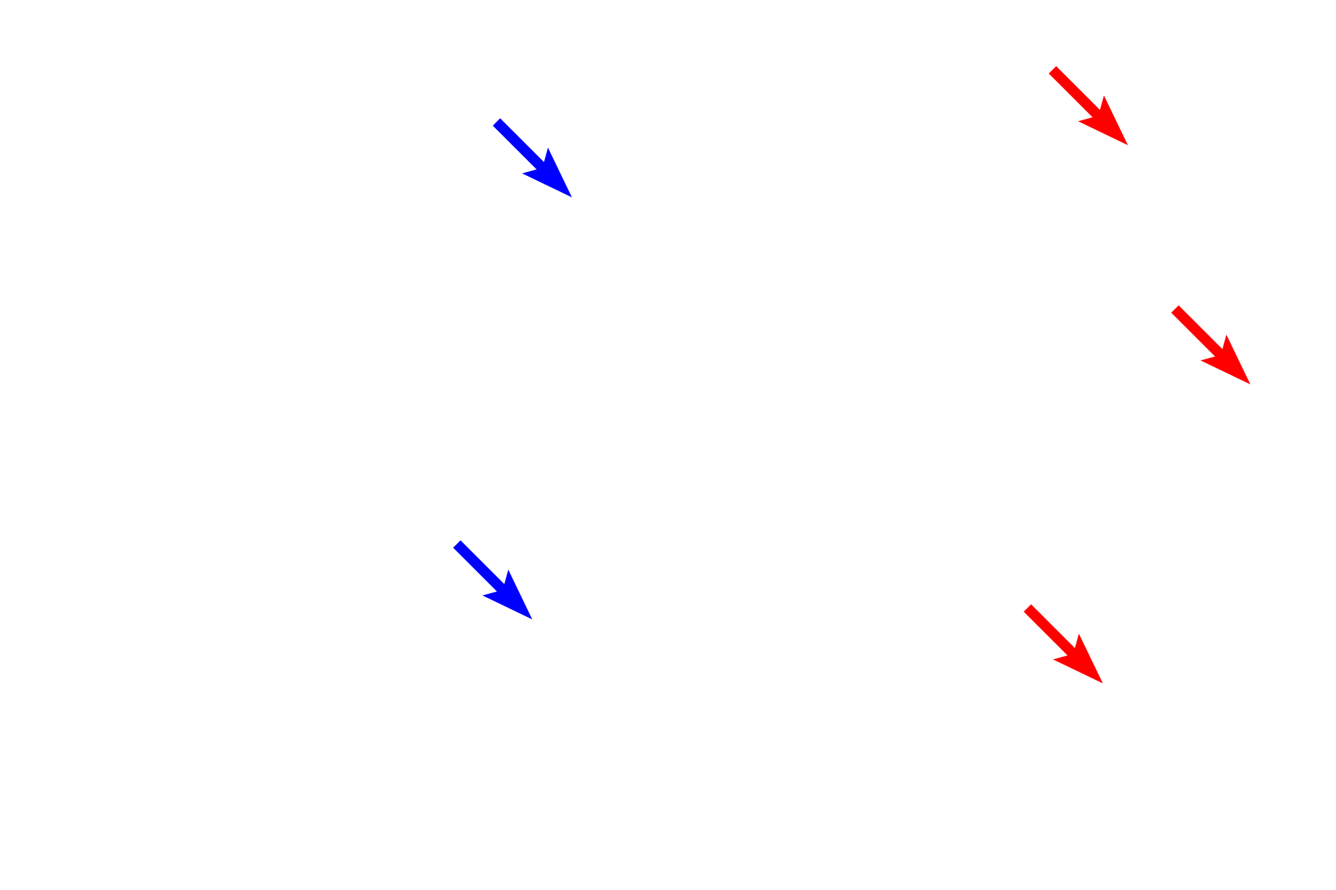  -- Collagen fibers <p>Pleura is composed of a simple squamous epithelium (mesothelium) overlying a layer of connective tissue that contains blood vessels and elastic fibers. </p>
