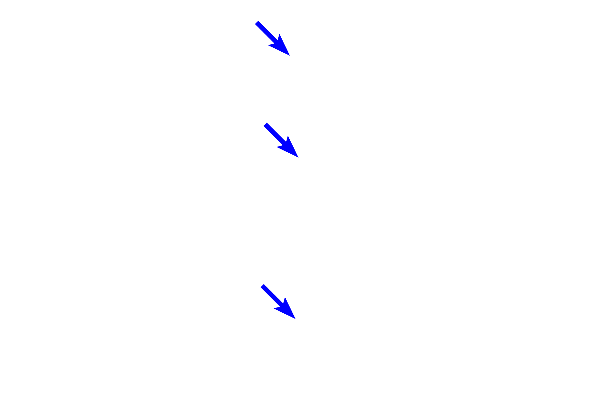  - Mesothelium <p>Parietal pleura lines the inner walls of the thoracic cavity, diaphragm, and mediastinum. Composed of a mesothelium and a layer of loose connective tissue, it is tightly adherent to underlying structures and functions with the visceral pleura to maintain the negative pressure required for normal breathing.</p>
