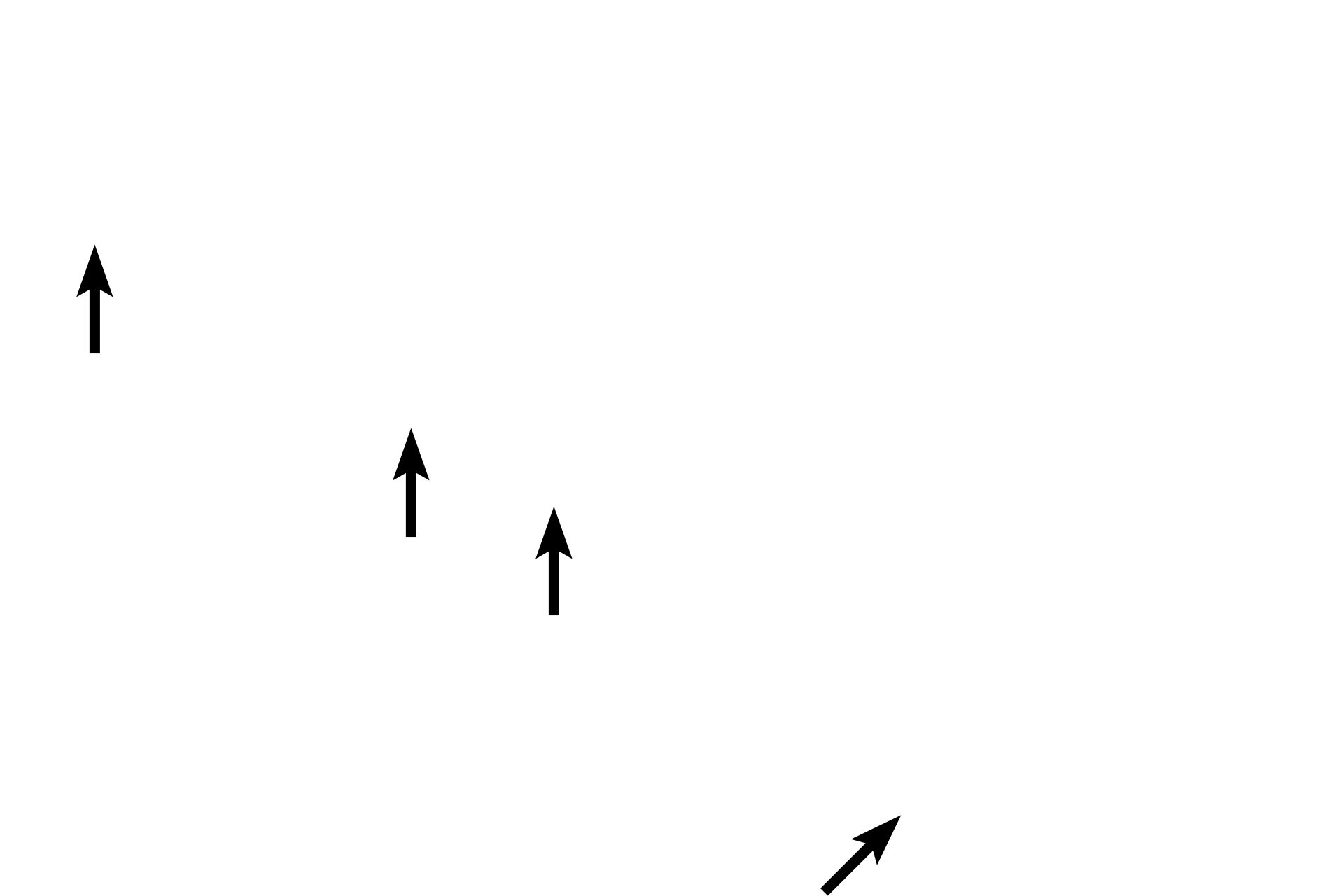  - Mesothelium <p>Visceral pleura covers the exterior of the lung and is composed of a mesothelium (simple squamous epithelium) and an underlying connective tissue containing elastic fibers and blood vessels. 200x </p>
