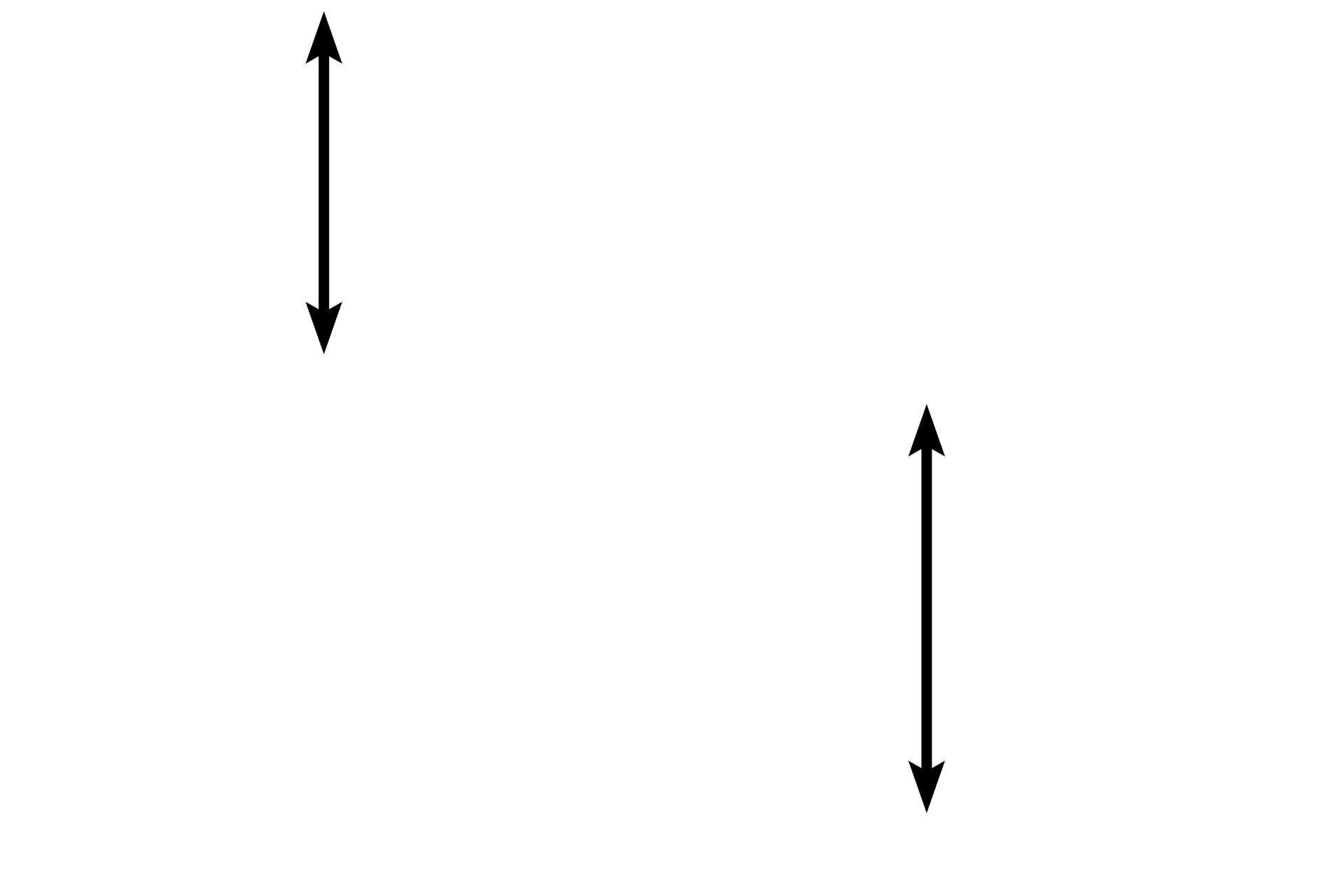  - Connective tissue layer <p>Visceral pleura covers the exterior of the lung and is composed of a mesothelium (simple squamous epithelium) and an underlying connective tissue containing elastic fibers and blood vessels. 200x </p>
