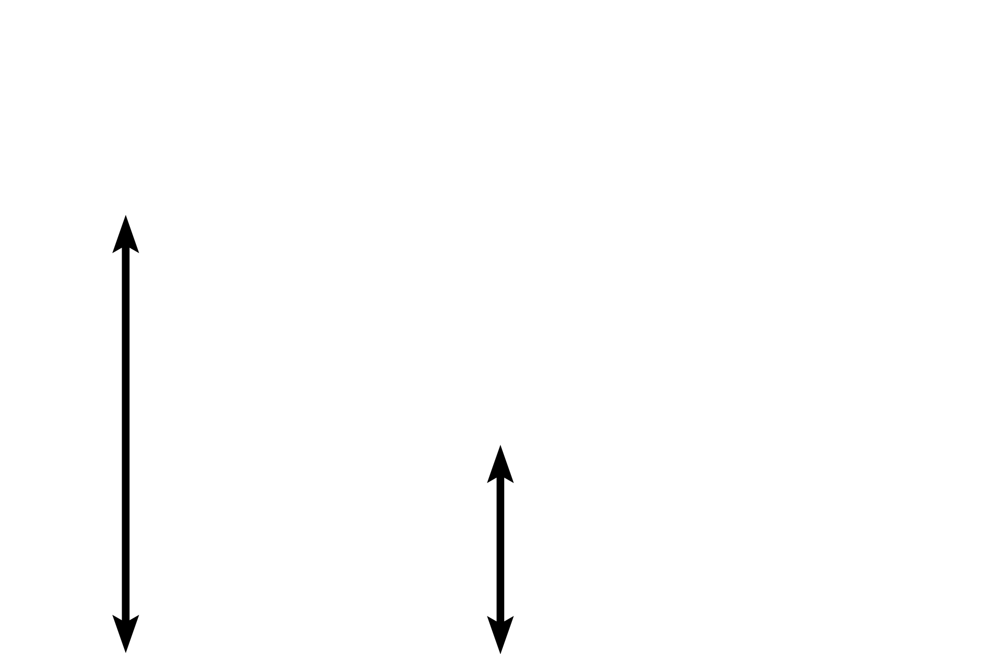 Pleural space <p>Visceral pleura covers the exterior of the lung and is composed of a mesothelium (simple squamous epithelium) and an underlying connective tissue containing elastic fibers and blood vessels. 200x </p>
