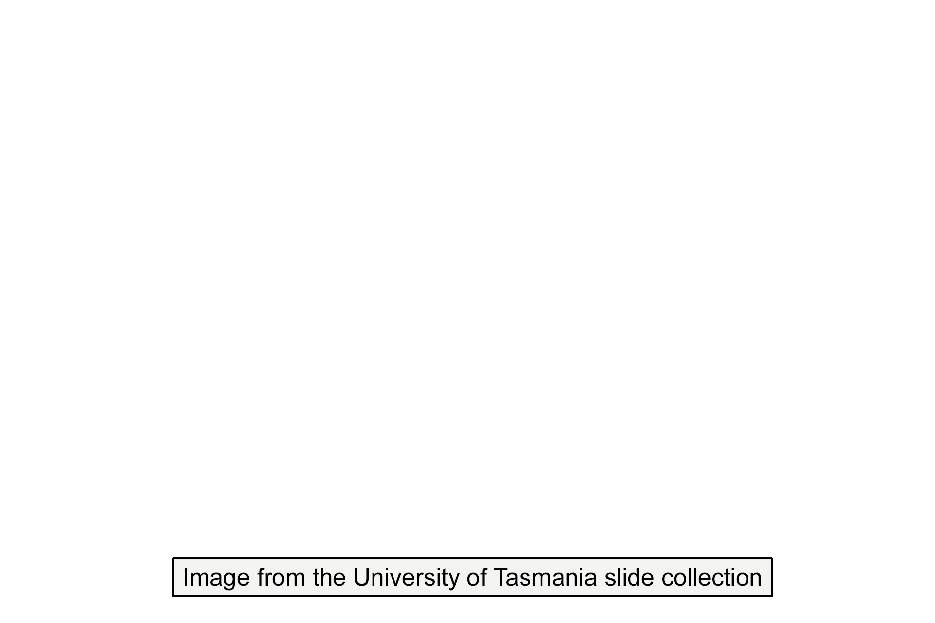 Image source >  <p>This image was taken of a slide in the University of Tasmania slide collection.</p>

