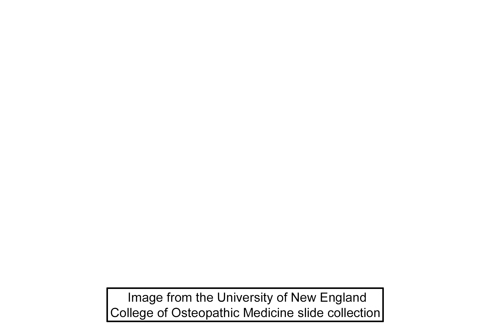 Image source <p>The image was taken of a slide in the University of New England College of Osteopathic Medicine collection.</p>
