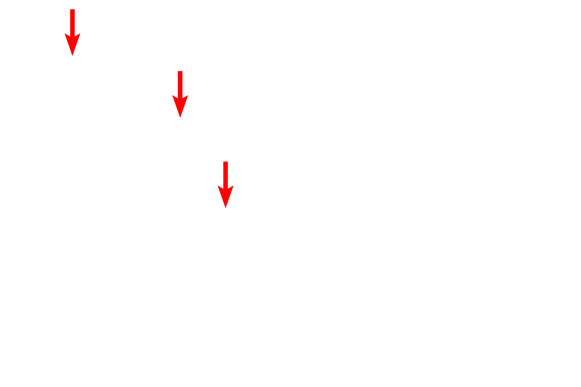 Cilia <p>Osmium tetroxide is both a stain and a fixative for lipid, a chemical reaction that produces a brown color visible by light microscopy. Lipid can be distributed as small, cytoplasmic droplets (left) or a single large droplet that nearly fills the cell (right). This latter distribution occurs in adipocytes, which are specialized fat storage cells. The use of osmium to preserve lipids for electron microscopy, provides electron density to tissues. Toluidine blue stain, 1000x, 1000x </p>
