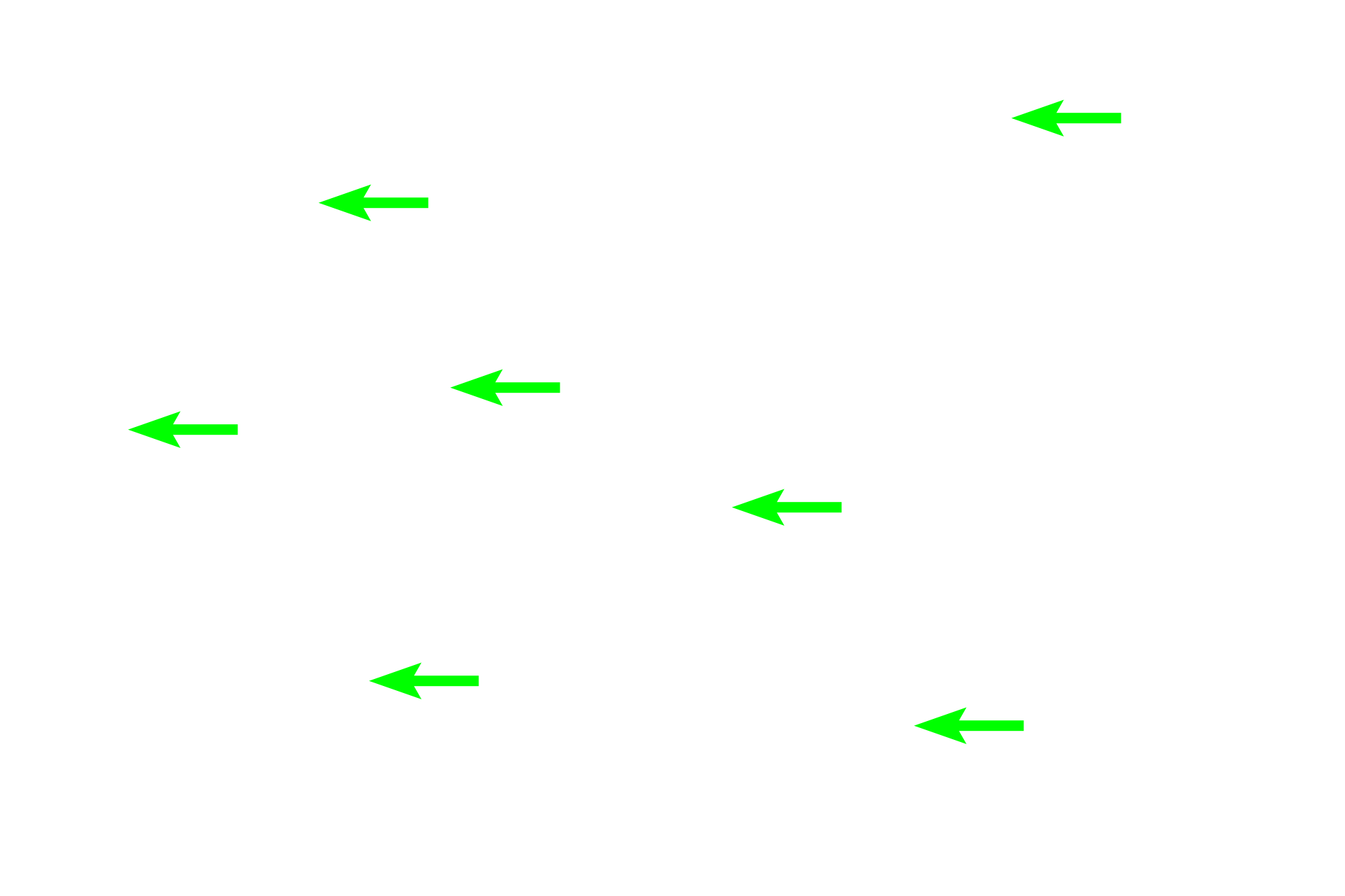 Elastic fibers <p>Elastin stains, such as Verhoeff’s-van Gieson, are used to specifically reveal elastic fibers and sheets. The specificity of the stain is due to the unique chemical properties of elastin, a major protein component of elastic fibers and sheets and results in a black or brown-colored stain. Elastin stains clearly distinguish elastic fibers from collagen fibers, both of which stain with eosin.  Connective tissue, 400x (l); Muscular artery, 200x (r) </p>
