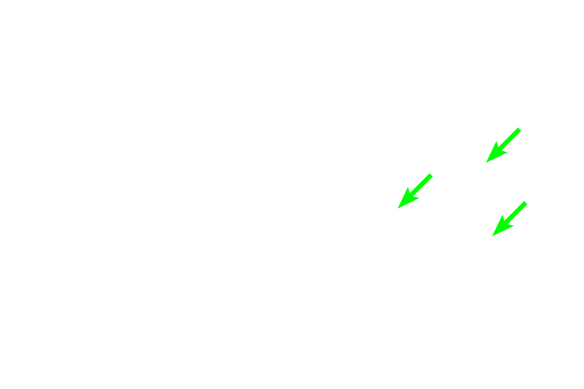 Elastic sheets <p>Elastin stains, such as Verhoeff’s-van Gieson, are used to specifically reveal elastic fibers and sheets. The specificity of the stain is due to the unique chemical properties of elastin, a major protein component of elastic fibers and sheets and results in a black or brown-colored stain. Elastin stains clearly distinguish elastic fibers from collagen fibers, both of which stain with eosin.  Connective tissue, 400x (l); Muscular artery, 200x (r)</p>

