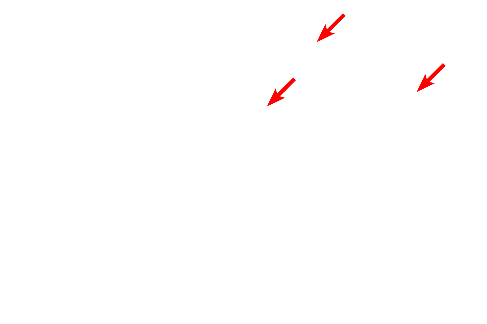Cilia <p>A basal body has the same structure as a centriole but is found at the base of a cilium or a flagellum. Both cilia and flagella are supported by a core of microtubules called the axoneme. The axoneme is composed of nine pairs of microtubules that extend from the basal body and surround a centrally located doublet of microtubules. The axoneme provides motility for the cilia and flagella.</p>
