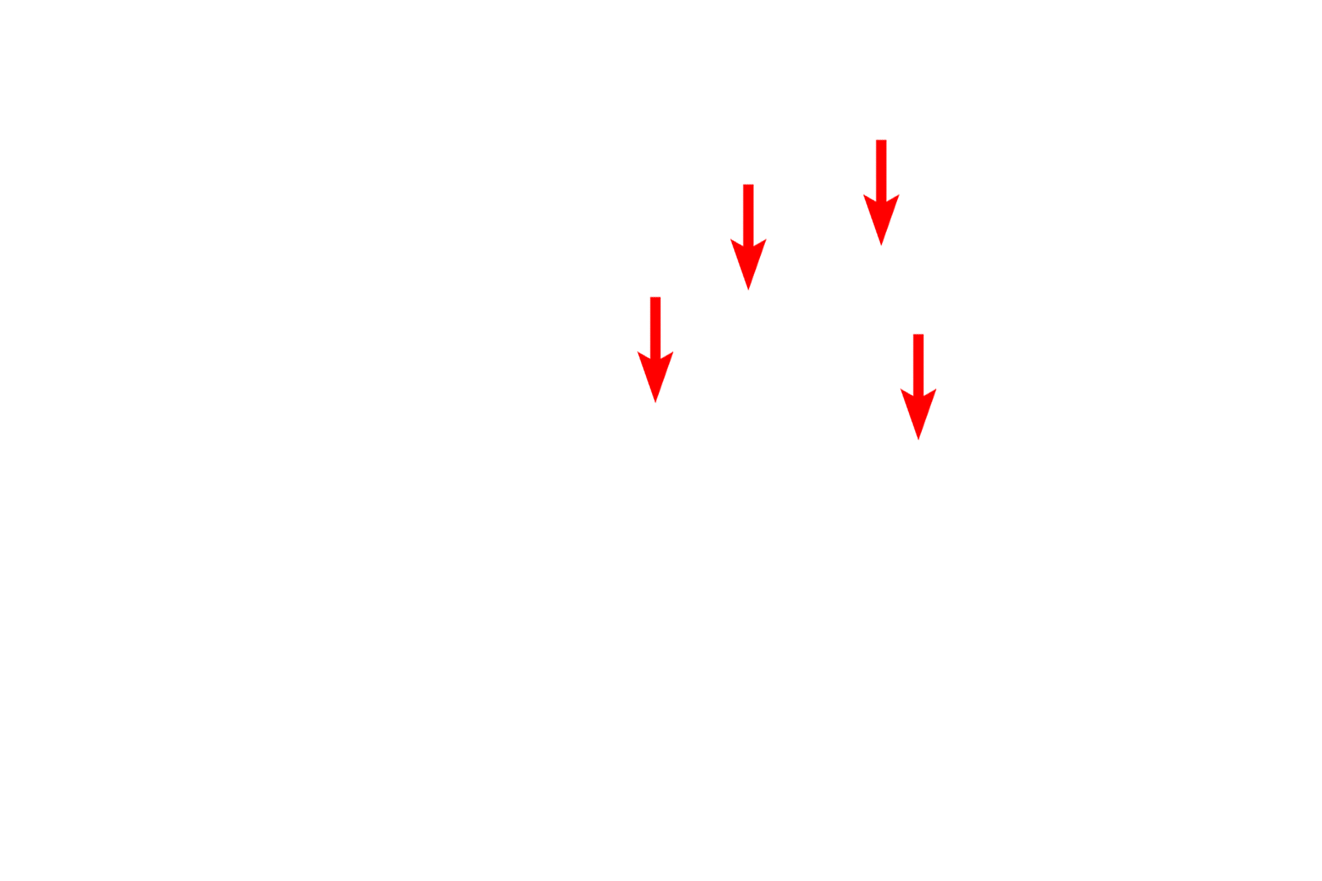  - RER cisterns <p>A unique distribution of RER and polysomes occurs in neurons where they collectively form Nissl bodies. By light microscopy (left), Nissl bodies are visible as highly basophilic masses in the cytoplasm. By electron microscopy (right), they can be seen to consist of parallel stacks of RER cisterns with polysomes between them. This type of association is found only in neurons.  1000x (l), 5000x</p>
