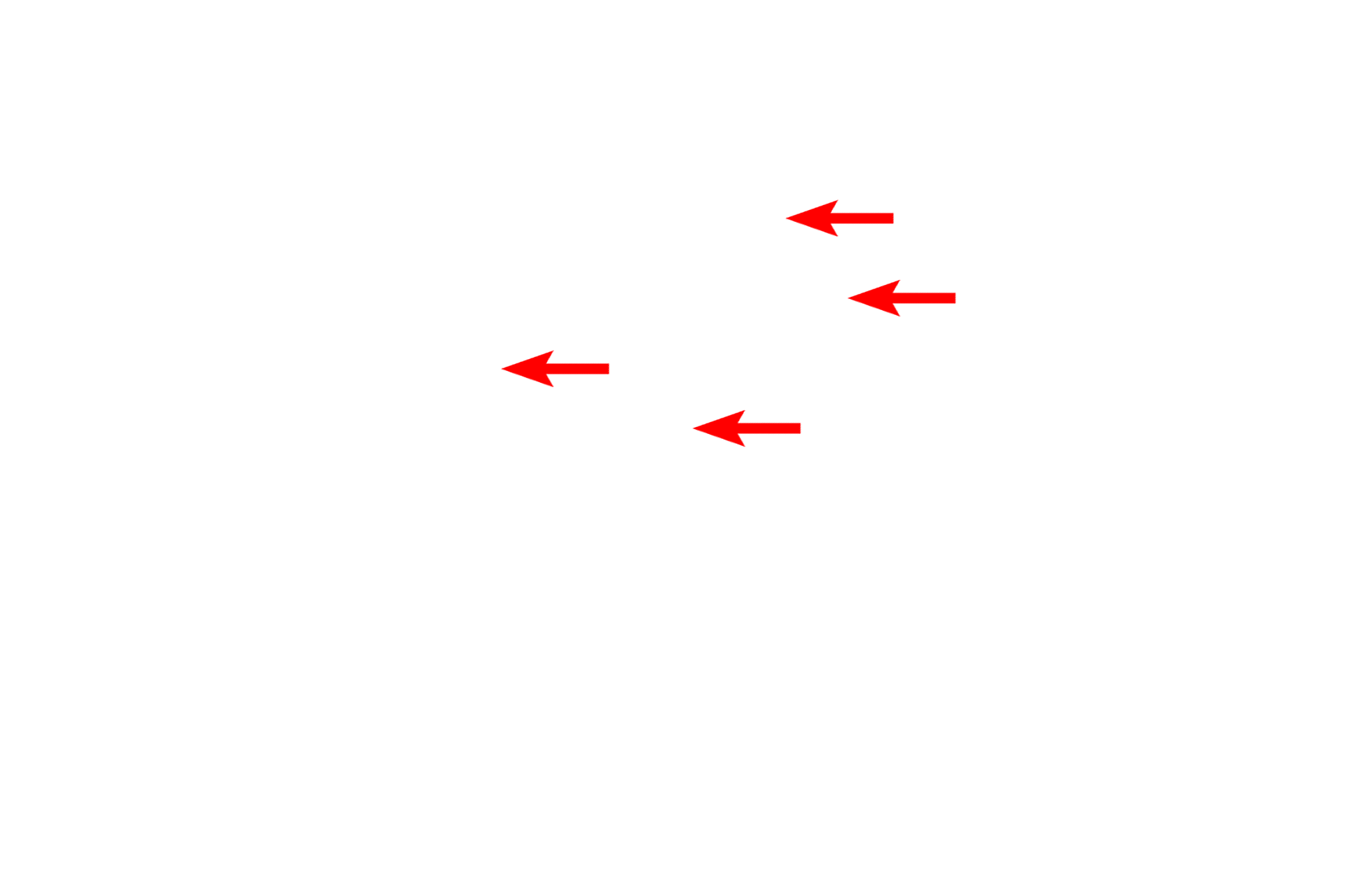  - Polysomes <p>A unique distribution of RER and polysomes occurs in neurons where they collectively form Nissl bodies. By light microscopy (left), Nissl bodies are visible as highly basophilic masses in the cytoplasm. By electron microscopy (right), they can be seen to consist of parallel stacks of RER cisterns with polysomes between them. This type of association is found only in neurons.  1000x (l), 5000x</p>
