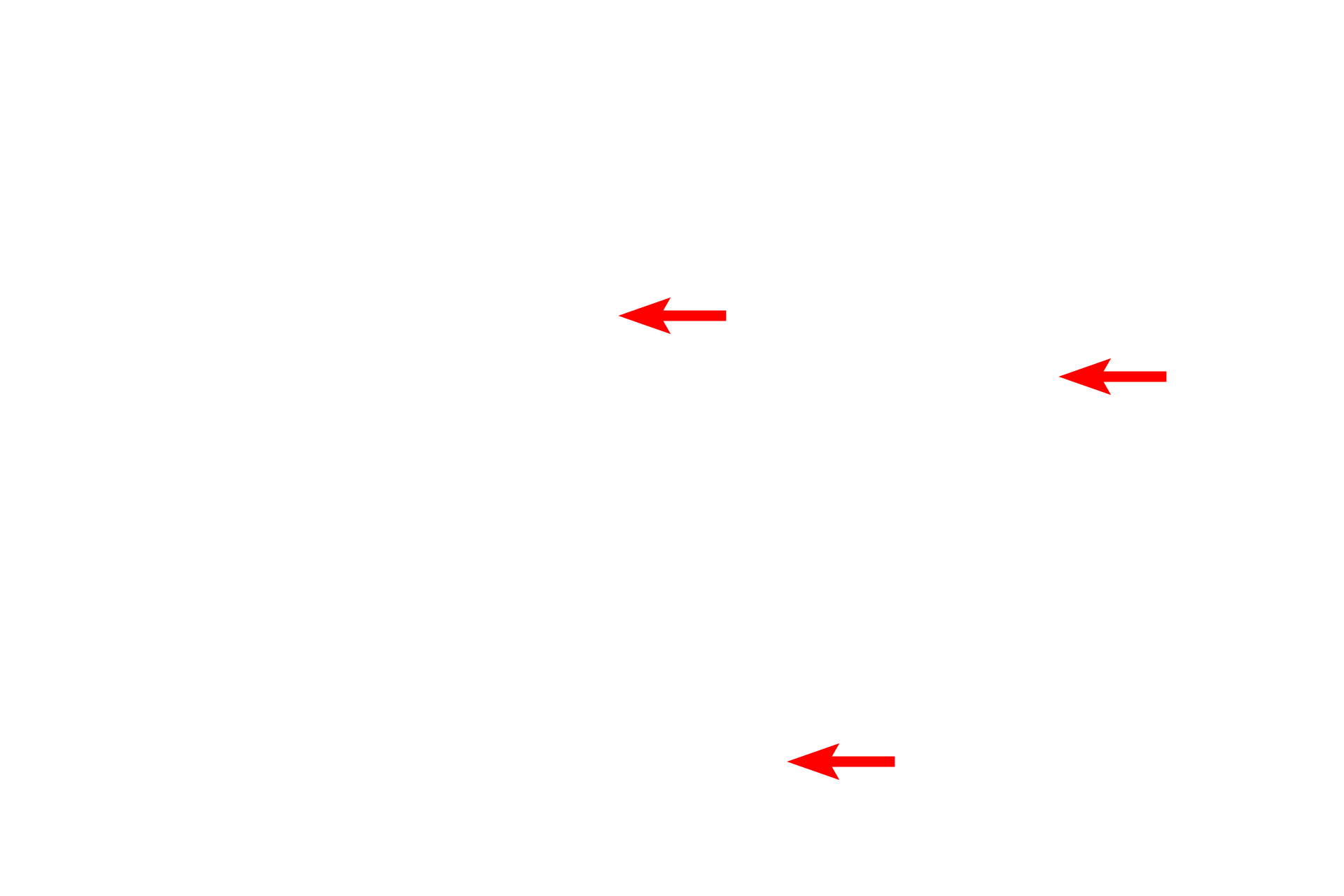 Mitochondria <p>A unique distribution of RER and polysomes occurs in neurons where they collectively form Nissl bodies. By light microscopy (left), Nissl bodies are visible as highly basophilic masses in the cytoplasm. By electron microscopy (right), they can be seen to consist of parallel stacks of RER cisterns with polysomes between them. This type of association is found only in neurons.  1000x (l), 5000x</p>
