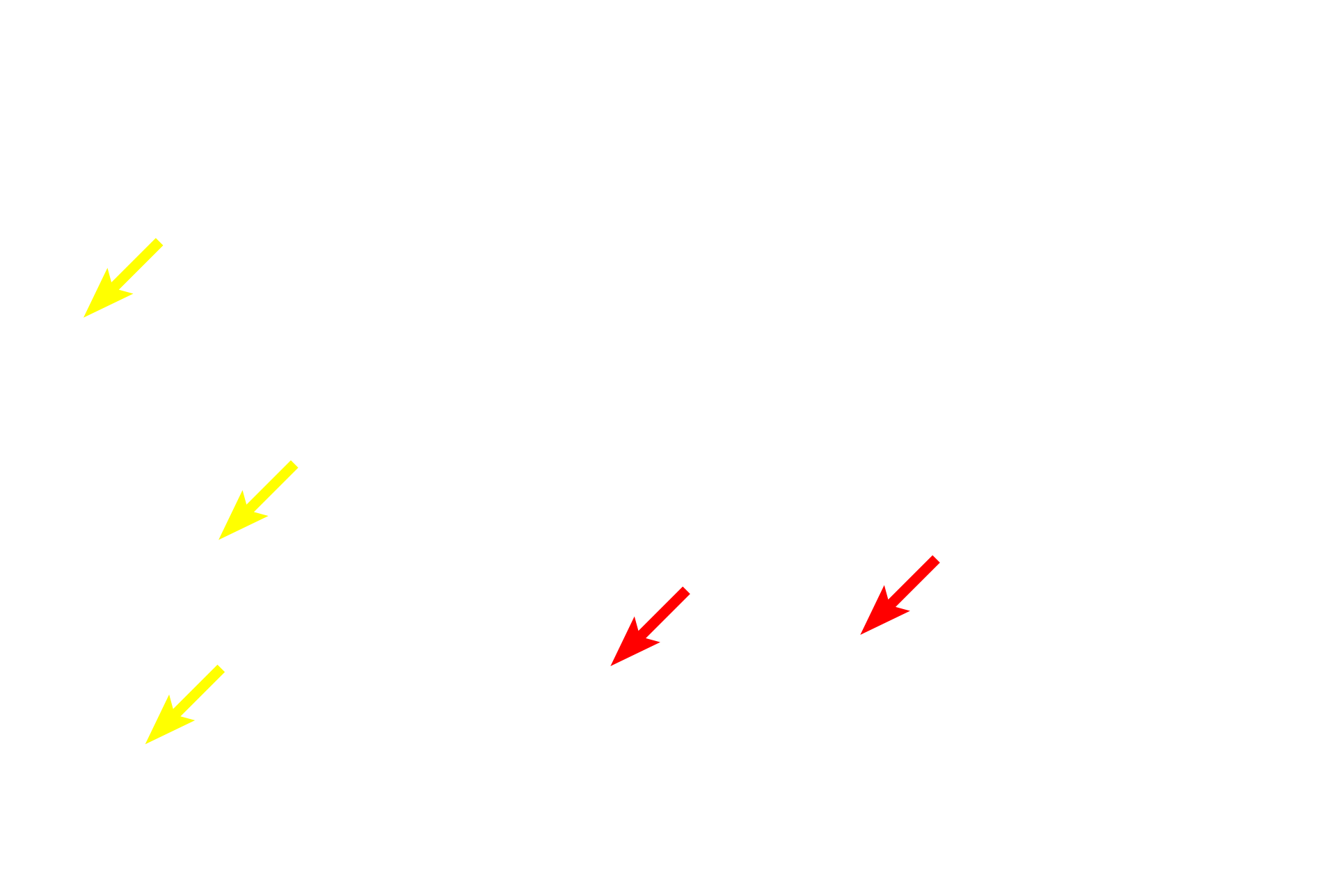  - Nucleoli <p>These images compare the appearance of glycogen in hepatocytes by light microscopy (left, PAS stain) and electron microscopy (right). Individual glycogen granules, which measure 15 to 40 nm in diameter, are too small to be resolved by light microscopy. However, aggregates of these granules, which measure up to 300 nm in diameter, can be visualized. By electron microscopy, aggregates and their individual granules are clearly evident.  1000x (l); 7500x (r)</p>
