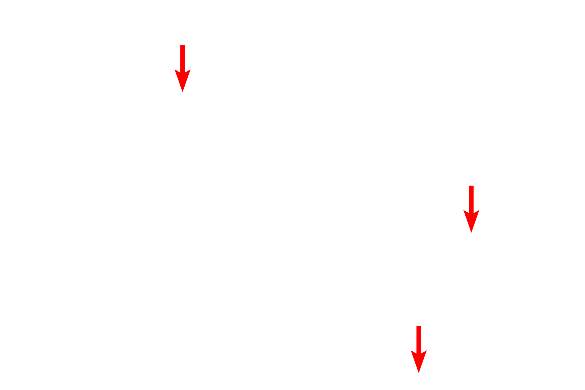 RER <p>These images compare the appearance of glycogen in hepatocytes by light microscopy (left, PAS stain) and electron microscopy (right). Individual glycogen granules, which measure 15 to 40 nm in diameter, are too small to be resolved by light microscopy. However, aggregates of these granules, which measure up to 300 nm in diameter, can be visualized. By electron microscopy, aggregates and their individual granules are clearly evident.  1000x (l); 7500x (r)</p>
