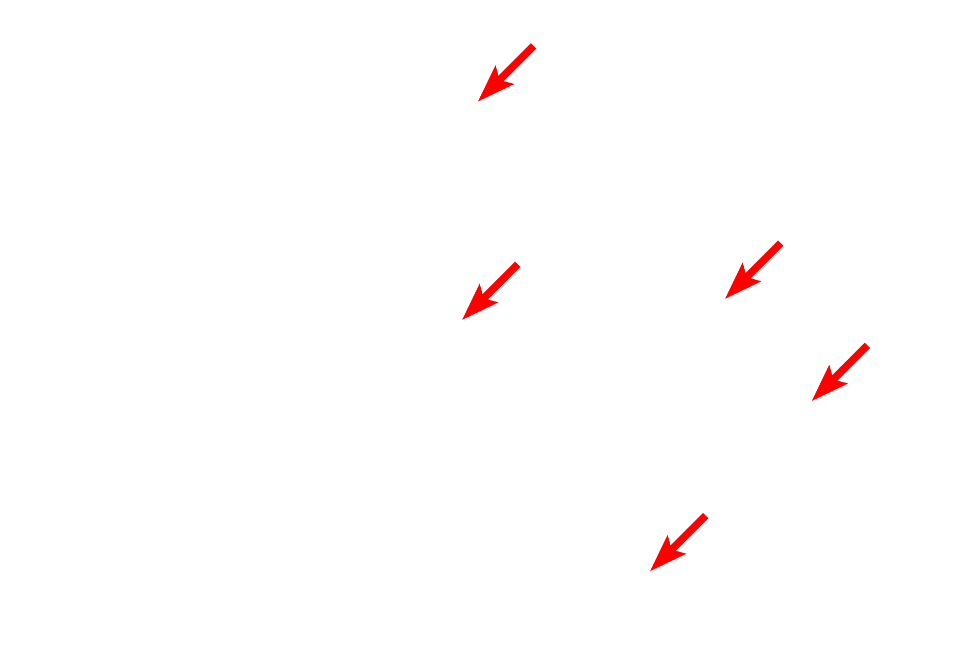 Glycogen granules <p>These images compare the appearance of glycogen in hepatocytes by light microscopy (left, PAS stain) and electron microscopy (right). Individual glycogen granules, which measure 15 to 40 nm in diameter, are too small to be resolved by light microscopy. However, aggregates of these granules, which measure up to 300 nm in diameter, can be visualized. By electron microscopy, aggregates and their individual granules are clearly evident.  1000x (l); 7500x (r)</p>
