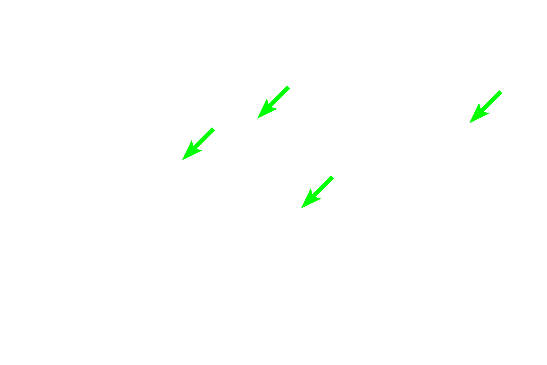Golgi apparatus <p>The location of the Golgi is clearly evident in this H&E stained section of the pituitary gland. The location of the Golgi apparatus appears as a pale-staining region of the cytoplasm adjacent to the nucleus, surrounded by the secretory granules it produces. The large Golgi displaces the granules thus resulting is a lightly stained region, referred to as “negative Golgi” image. The structure of the Golgi apparatus cannot be seen with H&E staining.  1000x</p>
