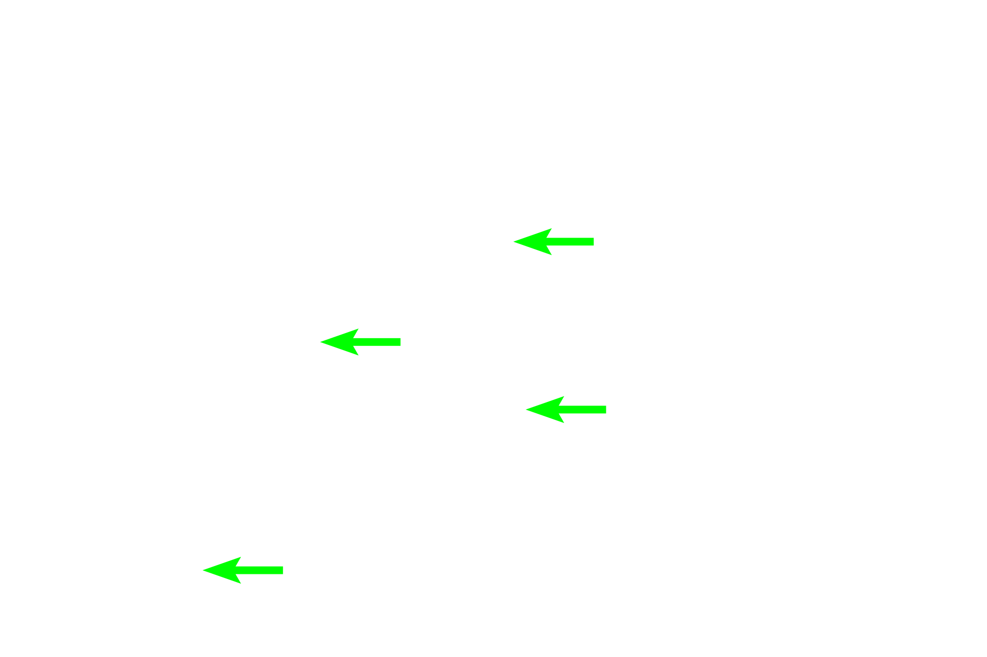  - Nucleoli <p>The location of the Golgi is clearly evident in this H&E stained section of the pituitary gland. The location of the Golgi apparatus appears as a pale-staining region of the cytoplasm adjacent to the nucleus, surrounded by the secretory granules it produces. The large Golgi displaces the granules thus resulting is a lightly stained region, referred to as “negative Golgi” image.  The structure of the Golgi apparatus cannot be seen with H&E staining.  1000x</p>
