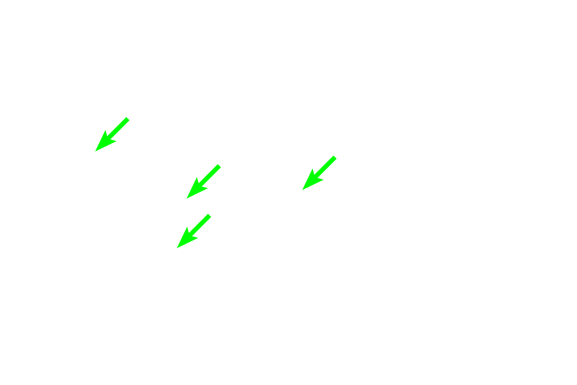 Negative Golgi <p>The plasma cells in this image display a prominent pale staining area next to their nuclei. This region, referred to as a “negative Golgi”, results from the displacement of the abundant, basophilically-stained rough endoplasmic reticulum around it. Plasma cells secrete antibodies.  1000x</p>
