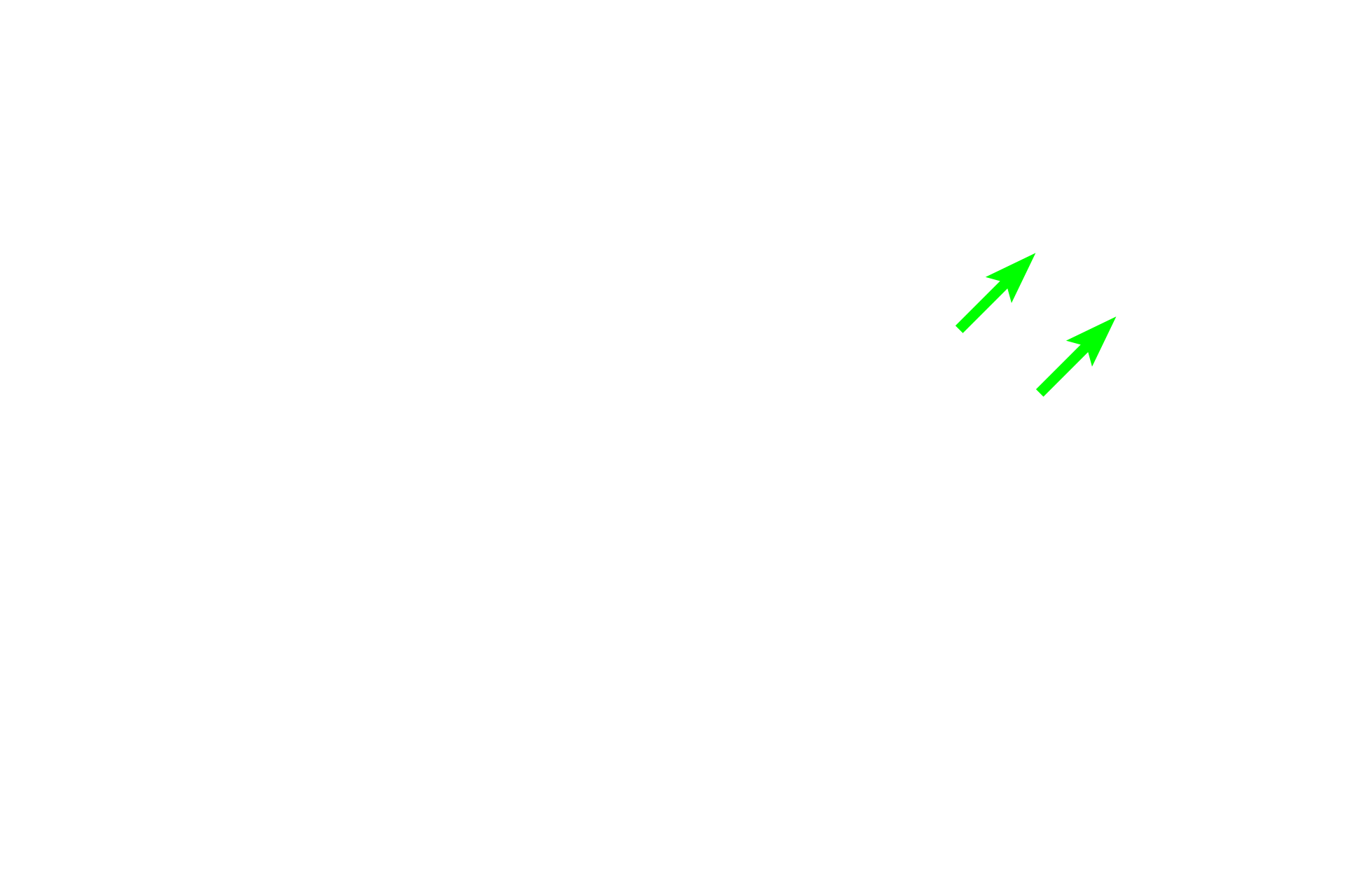 Mast cell <p>The plasma cells in this image display a prominent pale staining area next to their nuclei. This region, referred to as a “negative Golgi”, results from the displacement of the abundant, basophilically-stained rough endoplasmic reticulum around it. Plasma cells secrete antibodies.  1000x</p>
