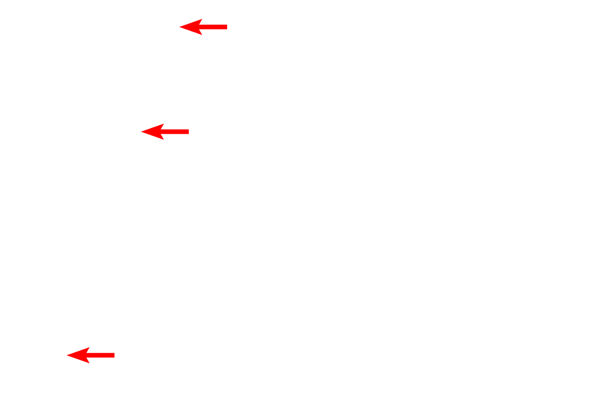 Mitochondria <p>This electron micrograph illustrates intracellular membranes, such as SER, RER and the two membranes of the nuclear envelope. The two membranes of mitochondria are also visible; the inner membrane folding inward to form cristae.  30,000x</p>
