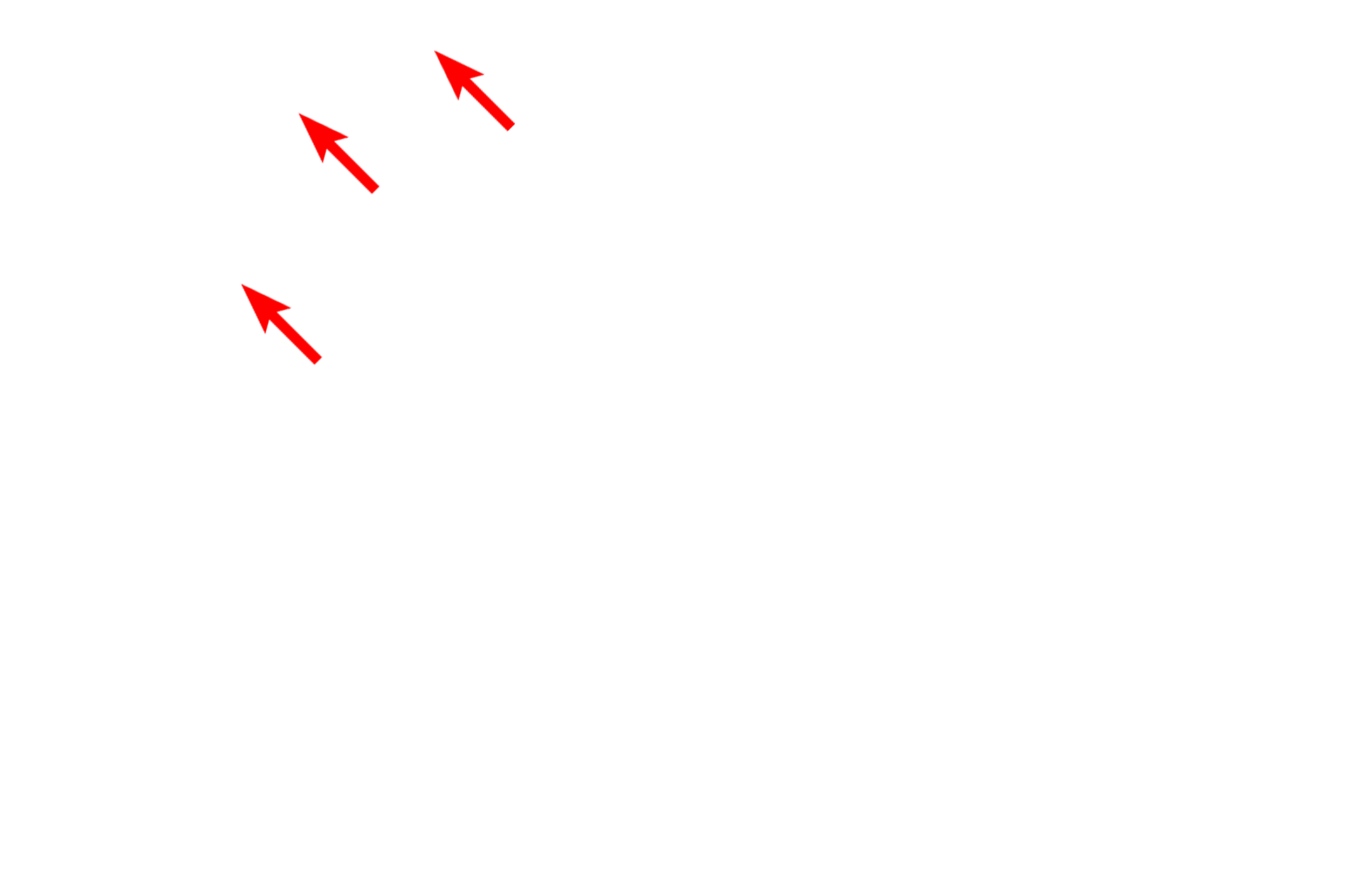  - Outer membrane <p>This electron micrograph illustrates intracellular membranes, such as SER, RER and the two membranes of the nuclear envelope. The two membranes of mitochondria are also visible; the inner membrane folding inward to form cristae.  30,000x</p>
