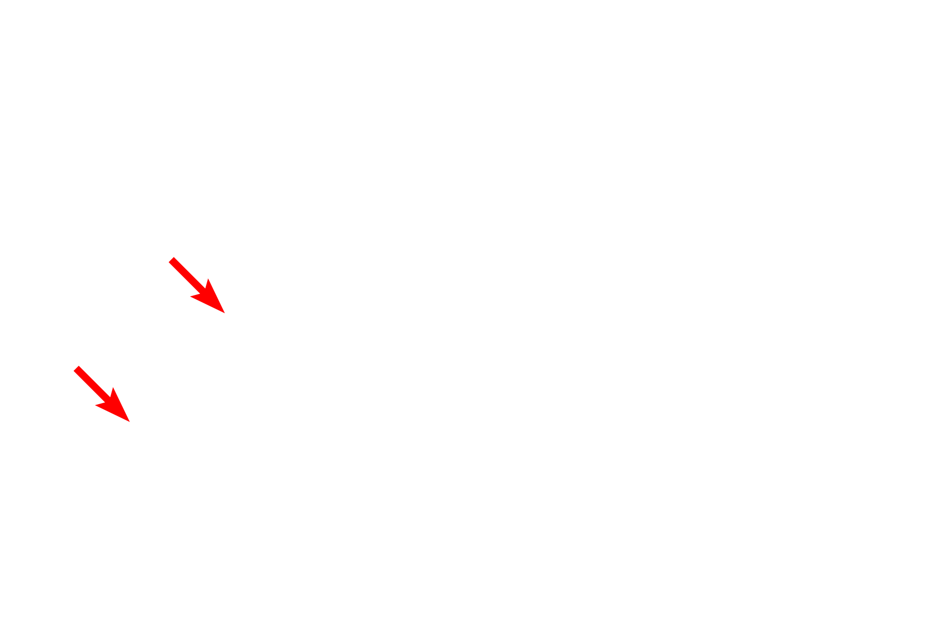 RER <p>This electron micrograph illustrates intracellular membranes, such as SER, RER and the two membranes of the nuclear envelope. The two membranes of mitochondria are also visible; the inner membrane folding inward to form cristae.  30,000x</p>
