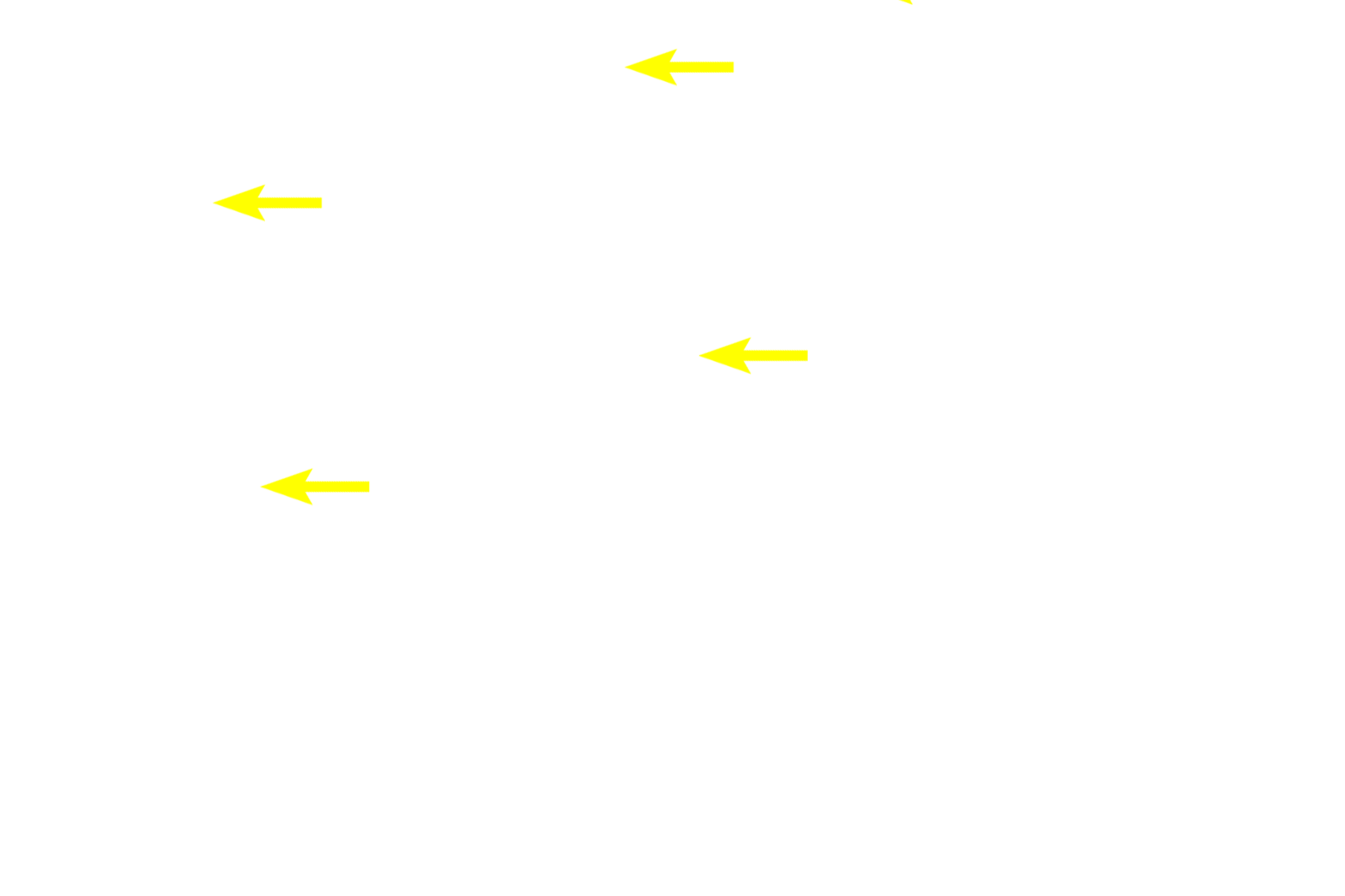 Collagen fibers <p>This image shows a variety of cell types in a connective tissue. The nucleus is the most prominent structure in the cell and shows basophilic staining due to the presence of DNA. Features such as nuclear shape, position and staining properties vary between cell types and are often used for cell identification. In some cases, the cytoplasm of a cell is not visible.  1000x</p>
