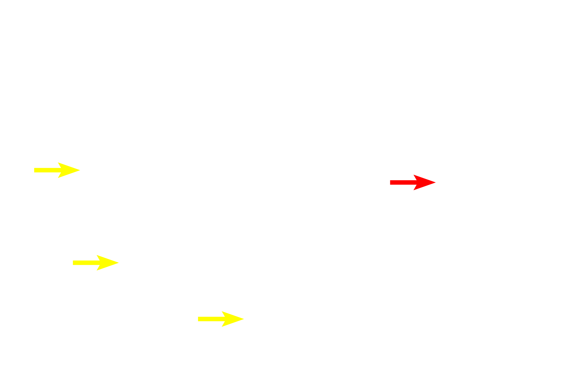Euchromatin >  <p>Euchromatin is pale staining and indicates loosely packed chromatin that allows accessibility of transcriptional machinery for gene expression. Visible on the left are active cells with euchromatic nuclei amongst the thymocytes. Their shape is difficult to discern in this section. The neuron on the right has a large cell body with ample cytoplasm surrounding the nucleus. </p>
