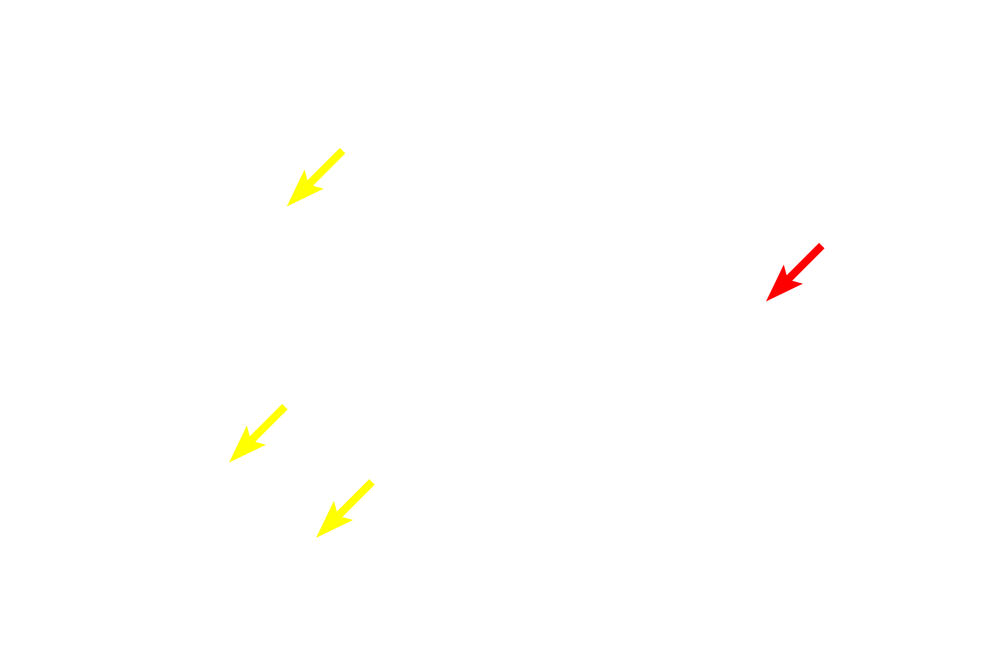 Nucleoli <p>Euchromatin is pale staining and indicates loosely packed chromatin that allows accessibility of transcriptional machinery for gene expression. Visible on the left are active cells with euchromatic nuclei amongst the thymocytes. Their shape is difficult to discern in this section. The neuron on the right has a large cell body with ample cytoplasm surrounding the nucleus. </p>
